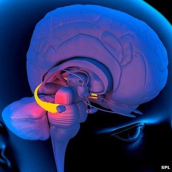 Artwork of a person's head showing the left hemisphere of the brain inside and the hippocampus in yellow