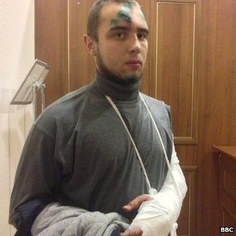 Mikhailo Niskoguz, his cuts covered with a green antiseptic, also says his arm was broken in the attack