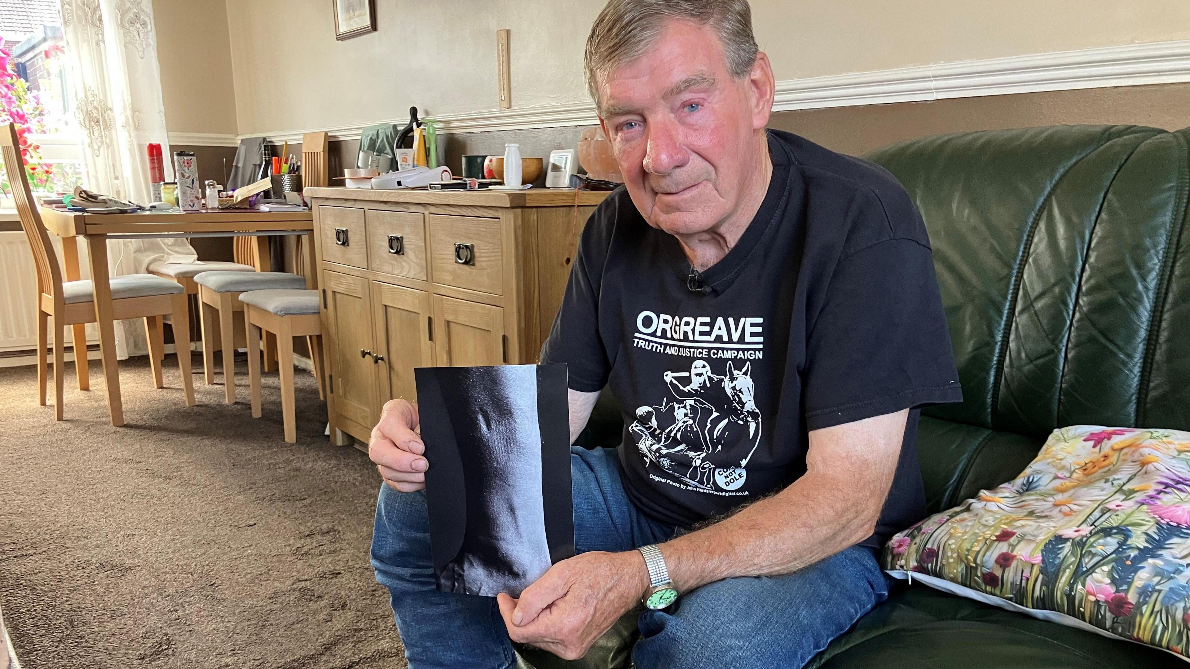A mature man sitting on a sofa, he has grey short hair and is wearing a T-shirt bearing the words Orgreave. In his hands he holds a picture in black and white showing his leg with a number of scars