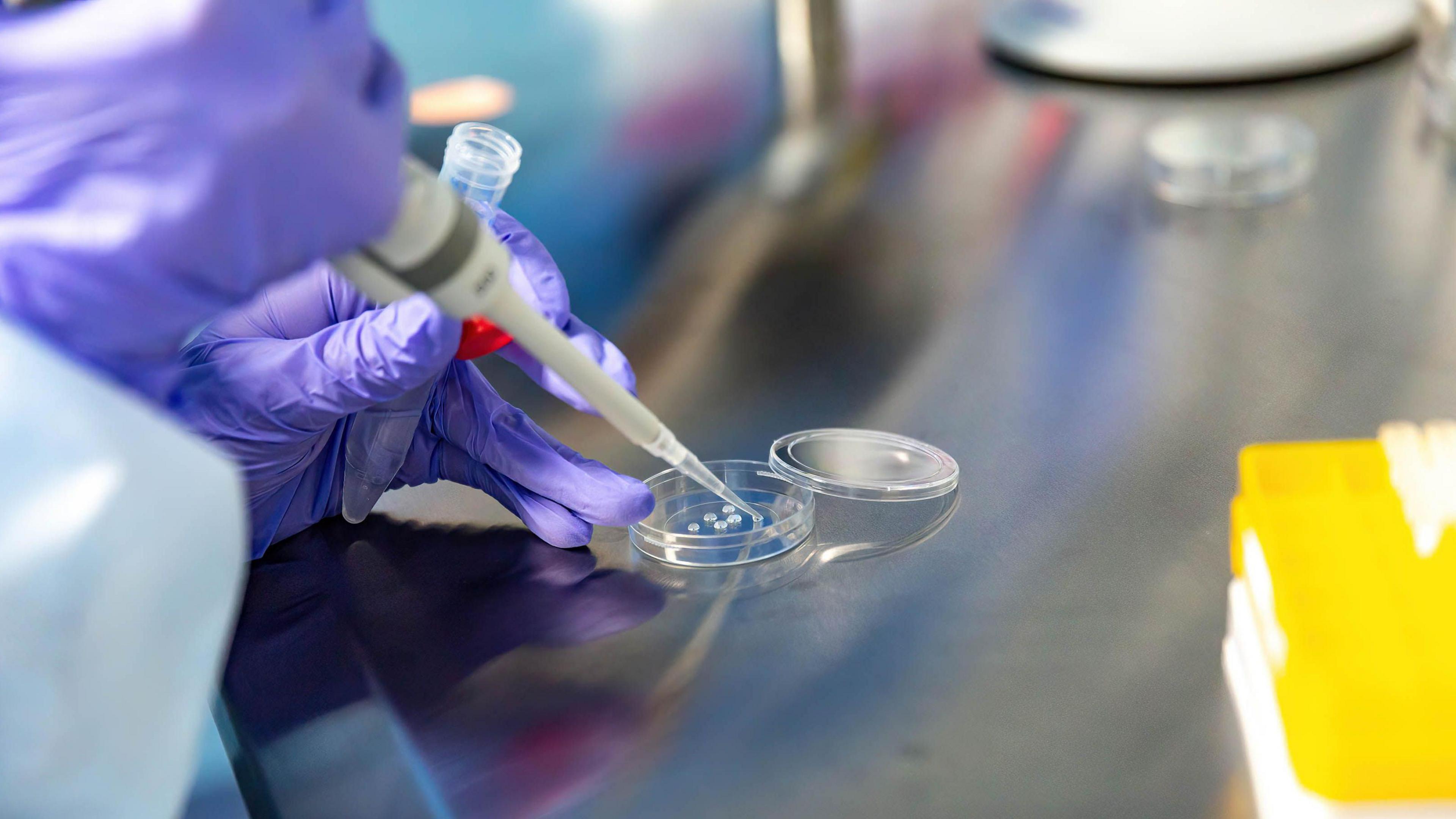 KYIV, UKRAINE - 2023/02/23: An embryologist, Oksana Lyzohub prepares reproductive cells in an IVF lab in 'IVMED' Fertility Center in central Kiev. IVMED Fertility Center offers semen cryopreservation (sperm freezing) to the Ukrainian Armed Forces free of charge. The programme aim is to preserve the sperm in case of reproductive health problems caused by injury or in case of death. As the full scale invasion of Ukraine by the Russian forces approaches its first anniversary there are many governmental and business projects that help the servicemen and women in their daily needs. (Photo by Dominika Zarzycka/SOPA Images/LightRocket via Getty Images)