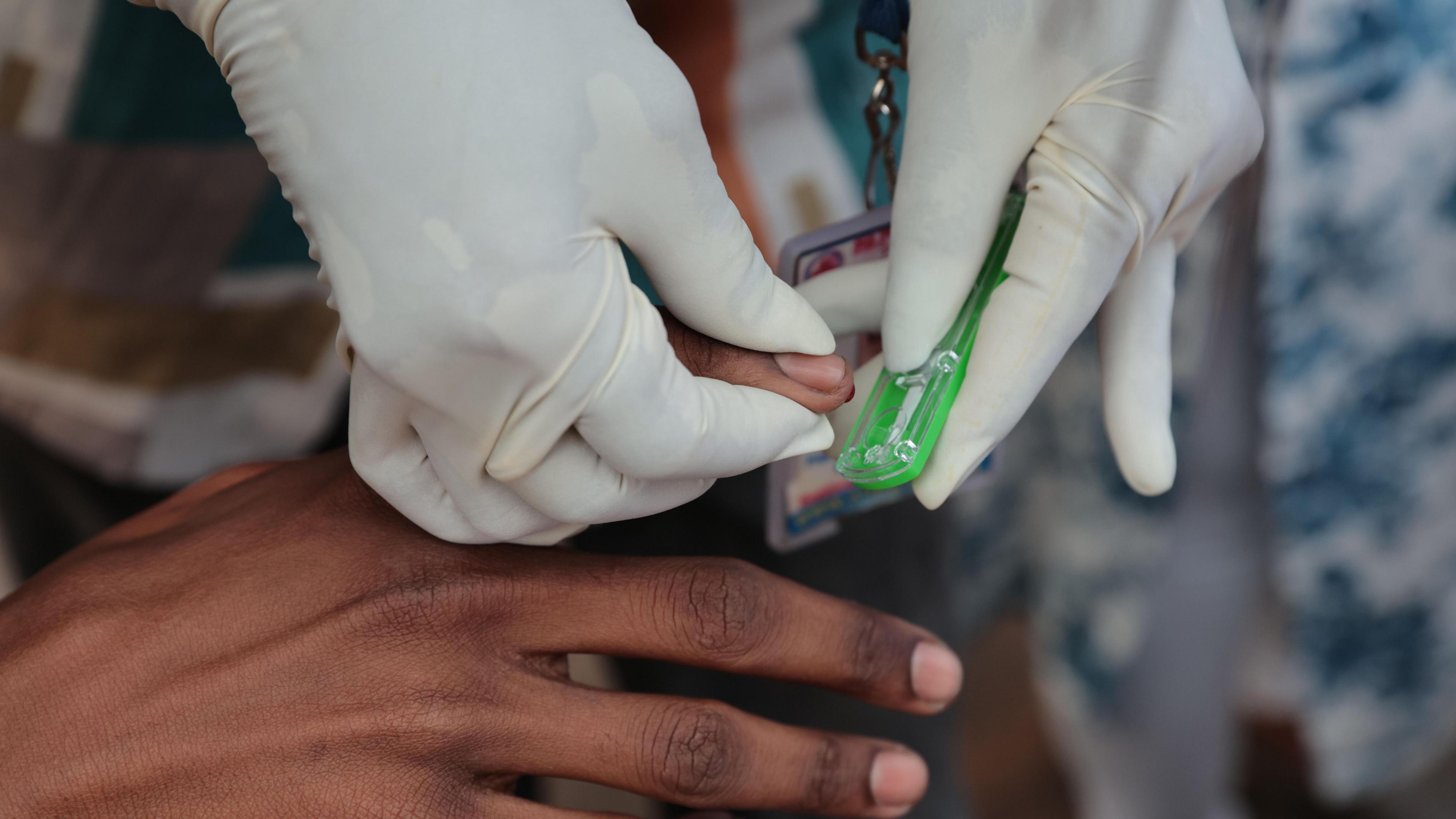 A healthcare worker wearing white gloves uses a green lancet device to prick the fingertip of a person’s hand for a blood sample, as part of an HIV test.