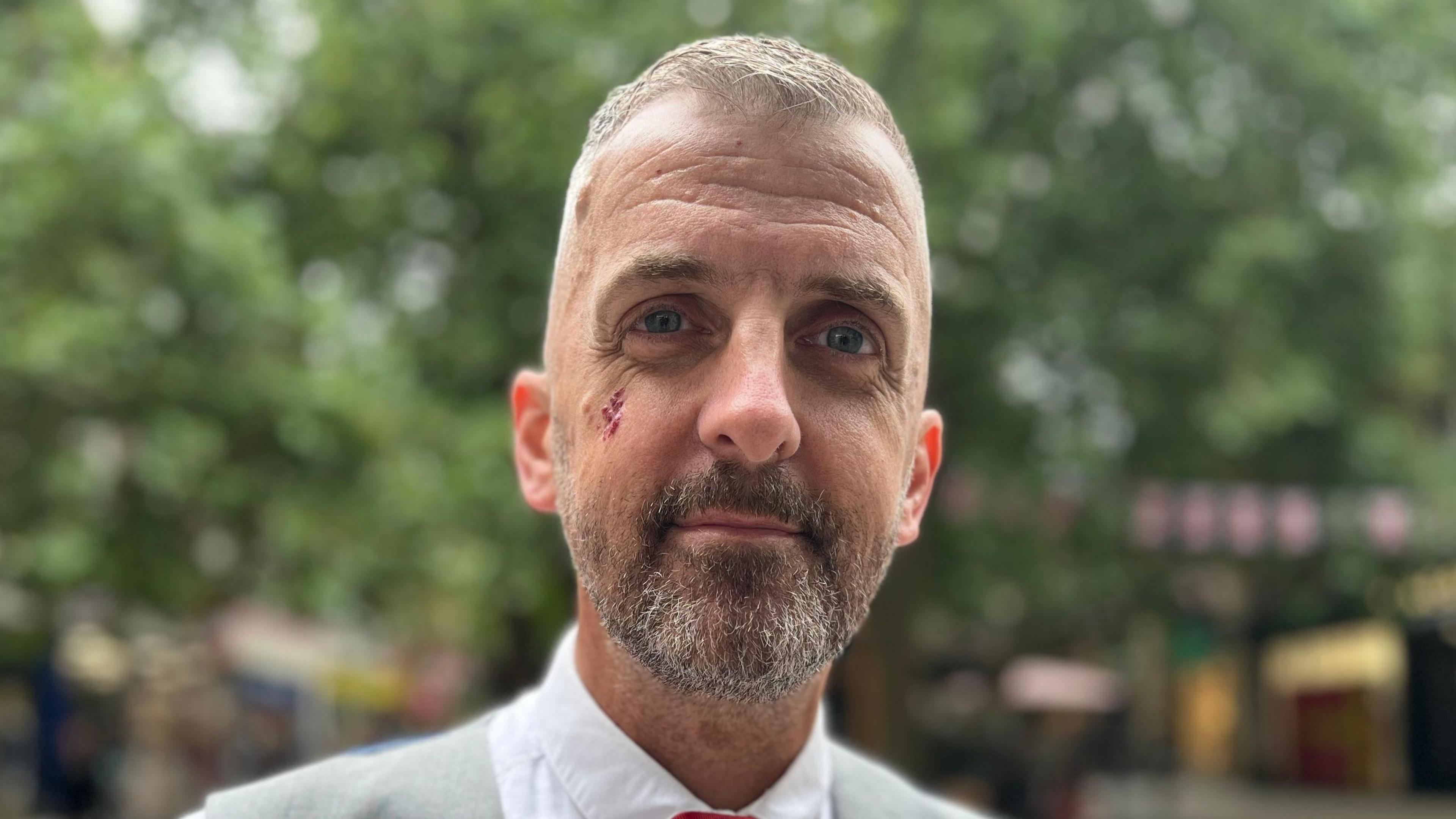 Christian O'Brien smiles at the camera as he is photographed outside. He is wearing a grey waistcoat and shirt and tie. He has a beard and grey hair. He has a small graze beneath his right eye. 
