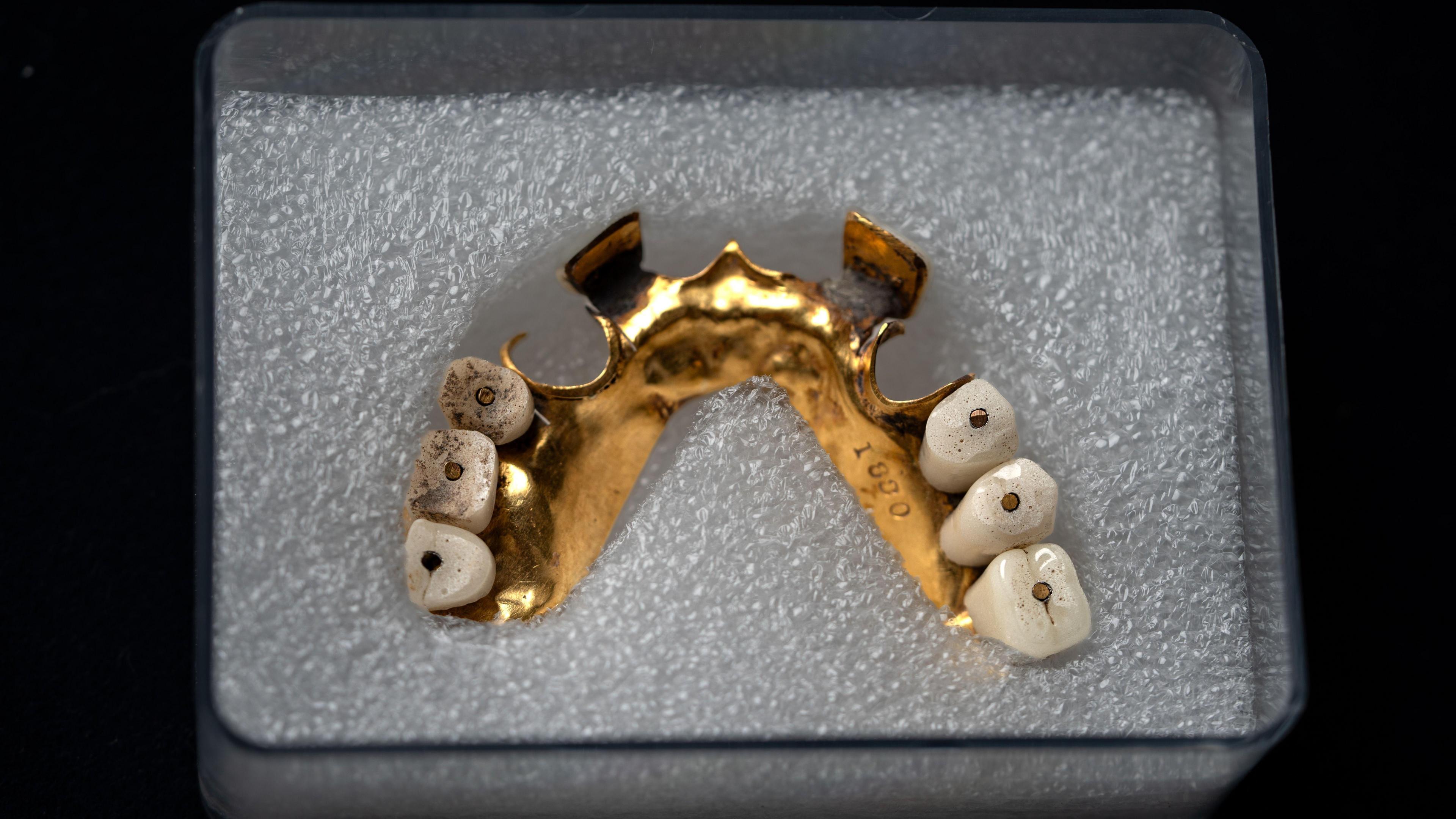 19th Century gold dentures