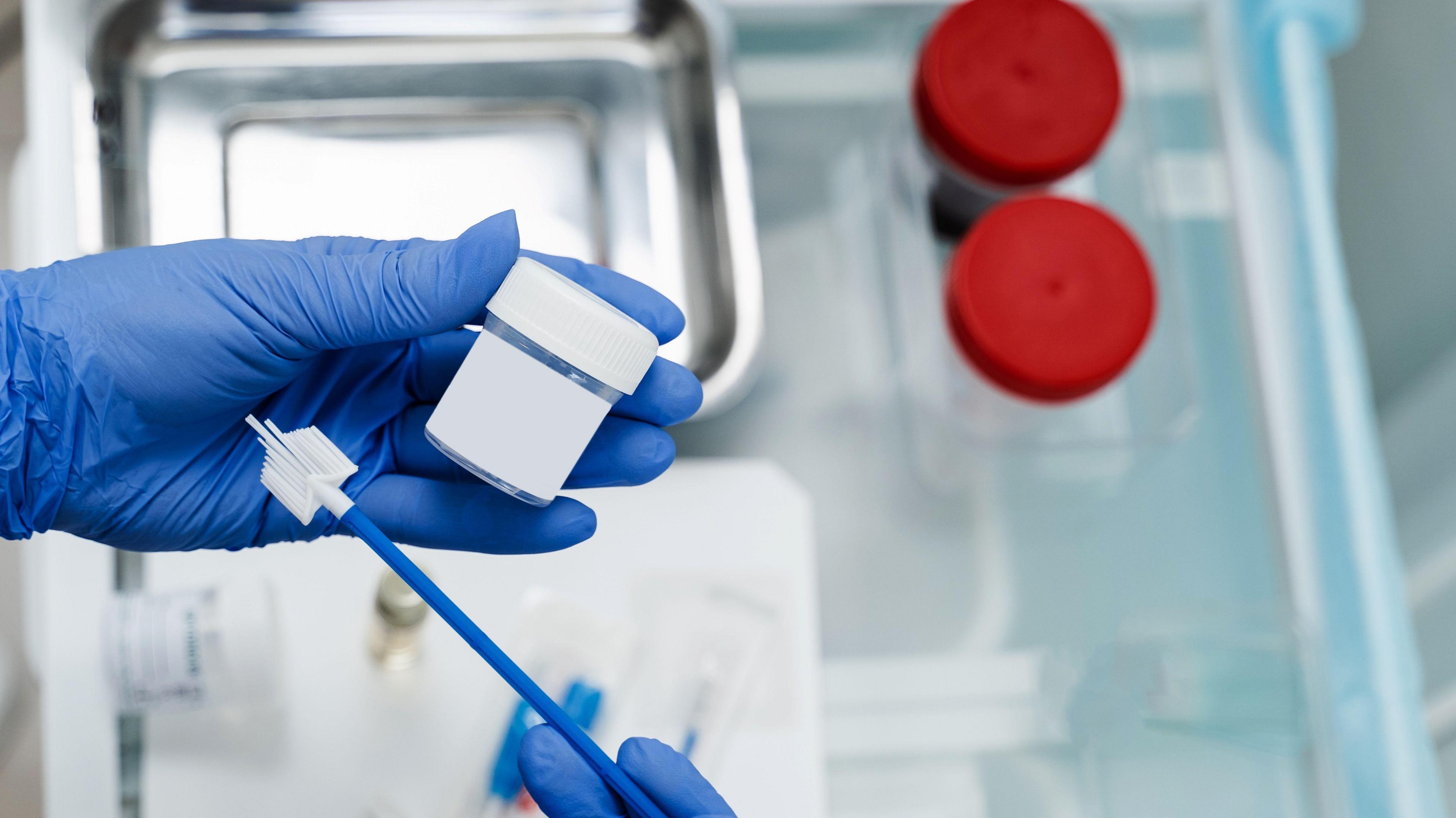 Gynecologist is holding flask for cytology Pap smear test in hands. They are wearing blue disposable gloves. There are several tubes sitting on a table.