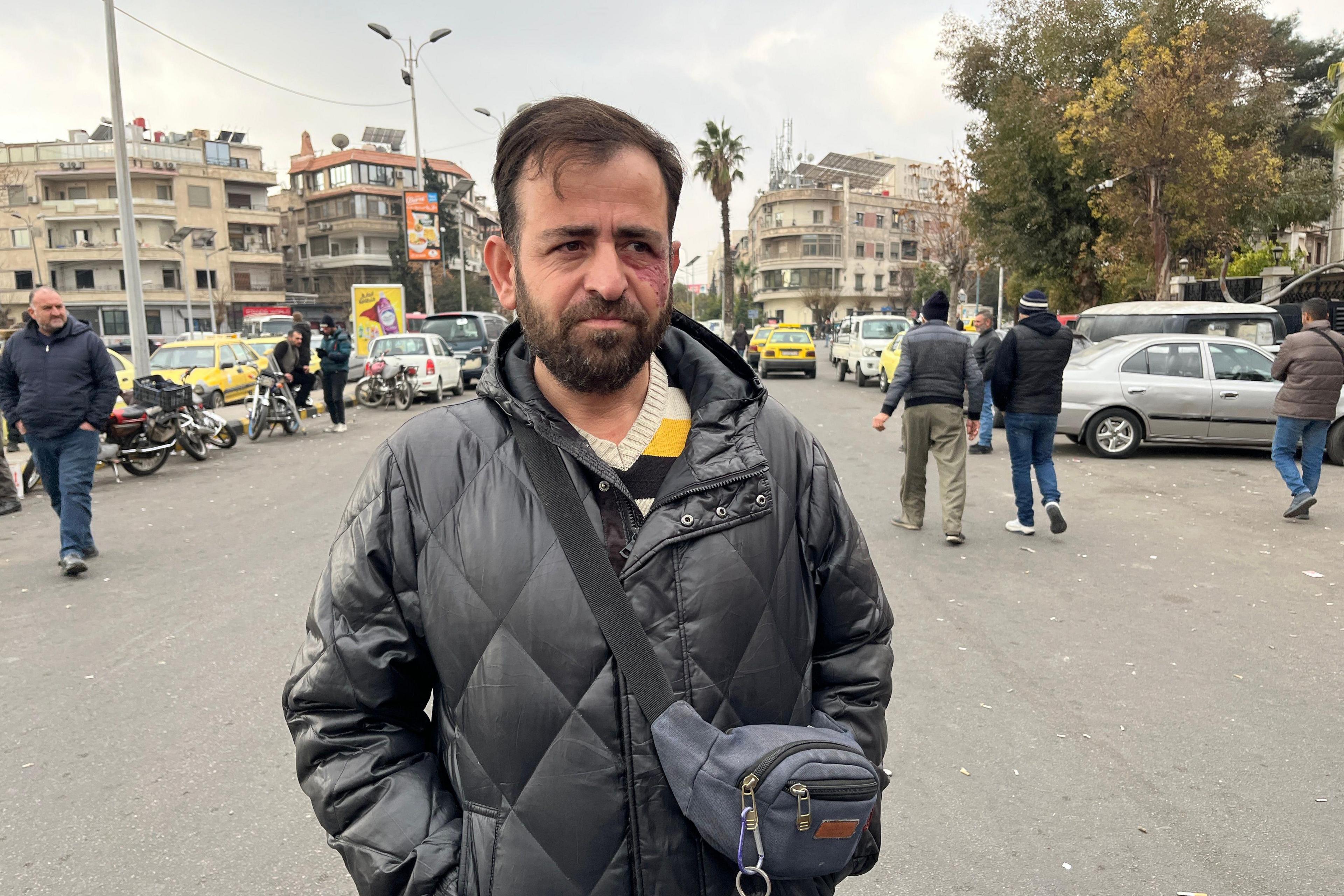 A man wearing a black padded jacket stands on the street in Damascus.