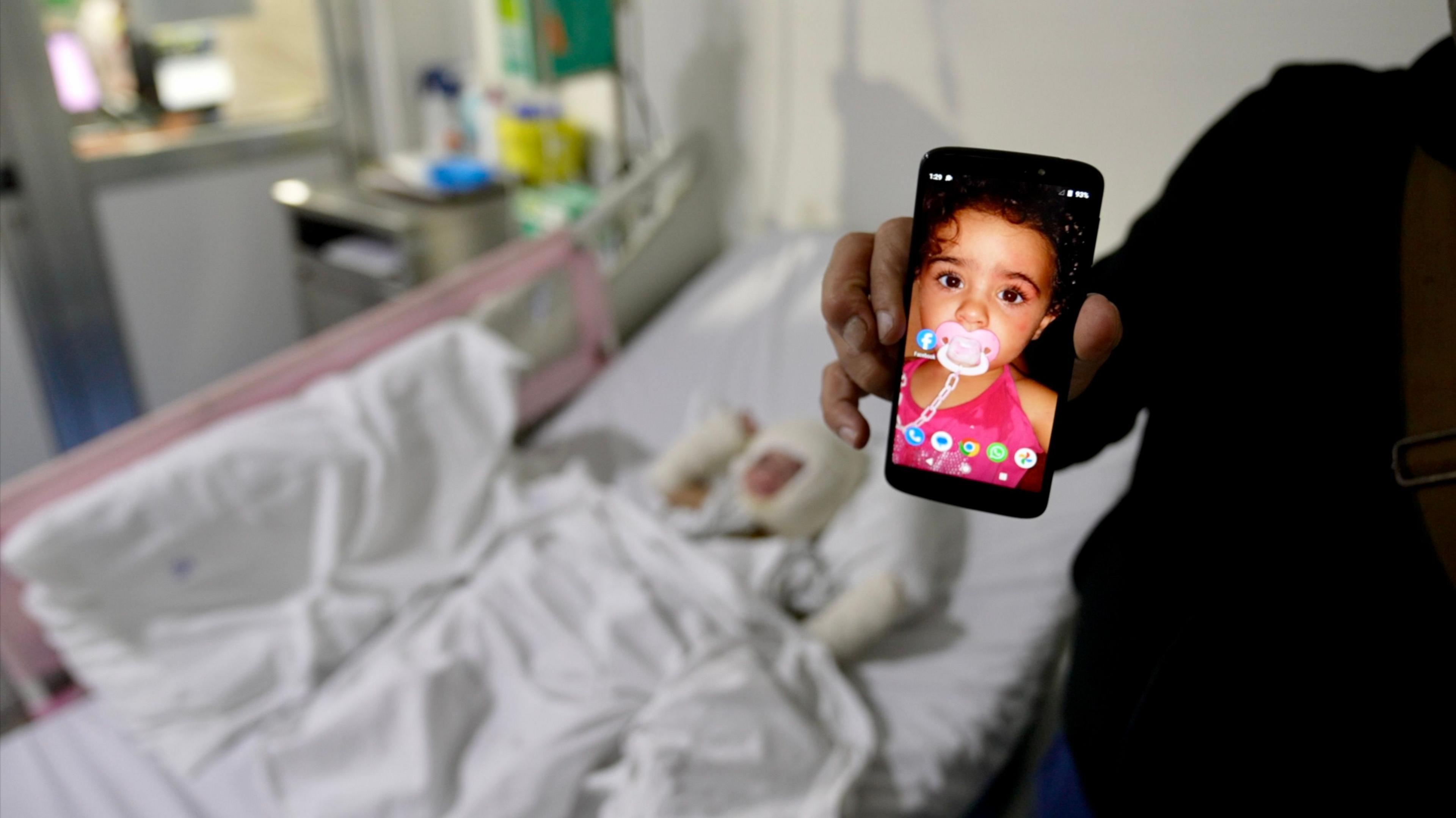 A man holds a phone with an image of a young child on it, as the little girl lies injured in a hospital bed behind him.