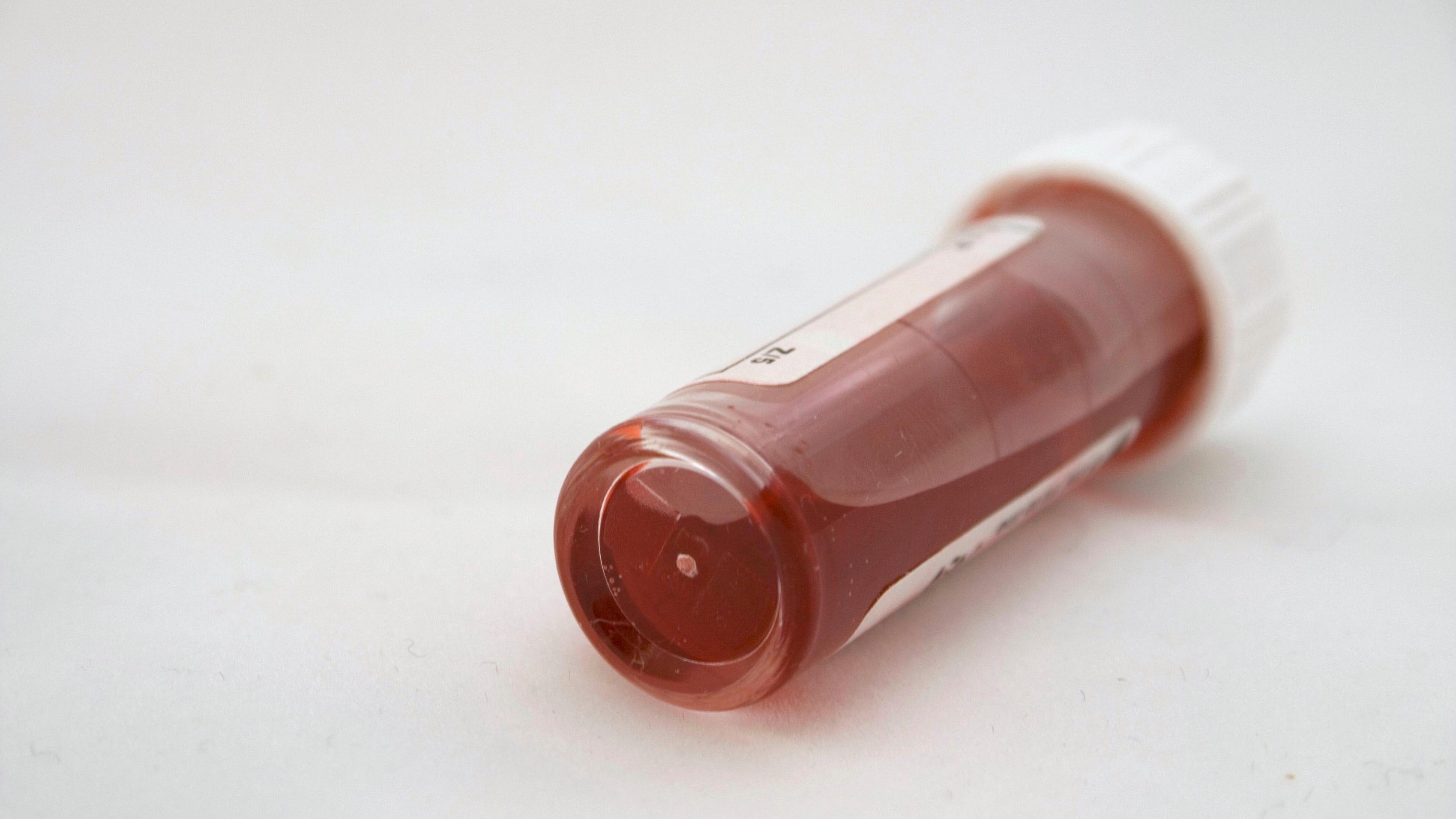 A vial of blood closed with a white plastic cap lies on its side on a white table 