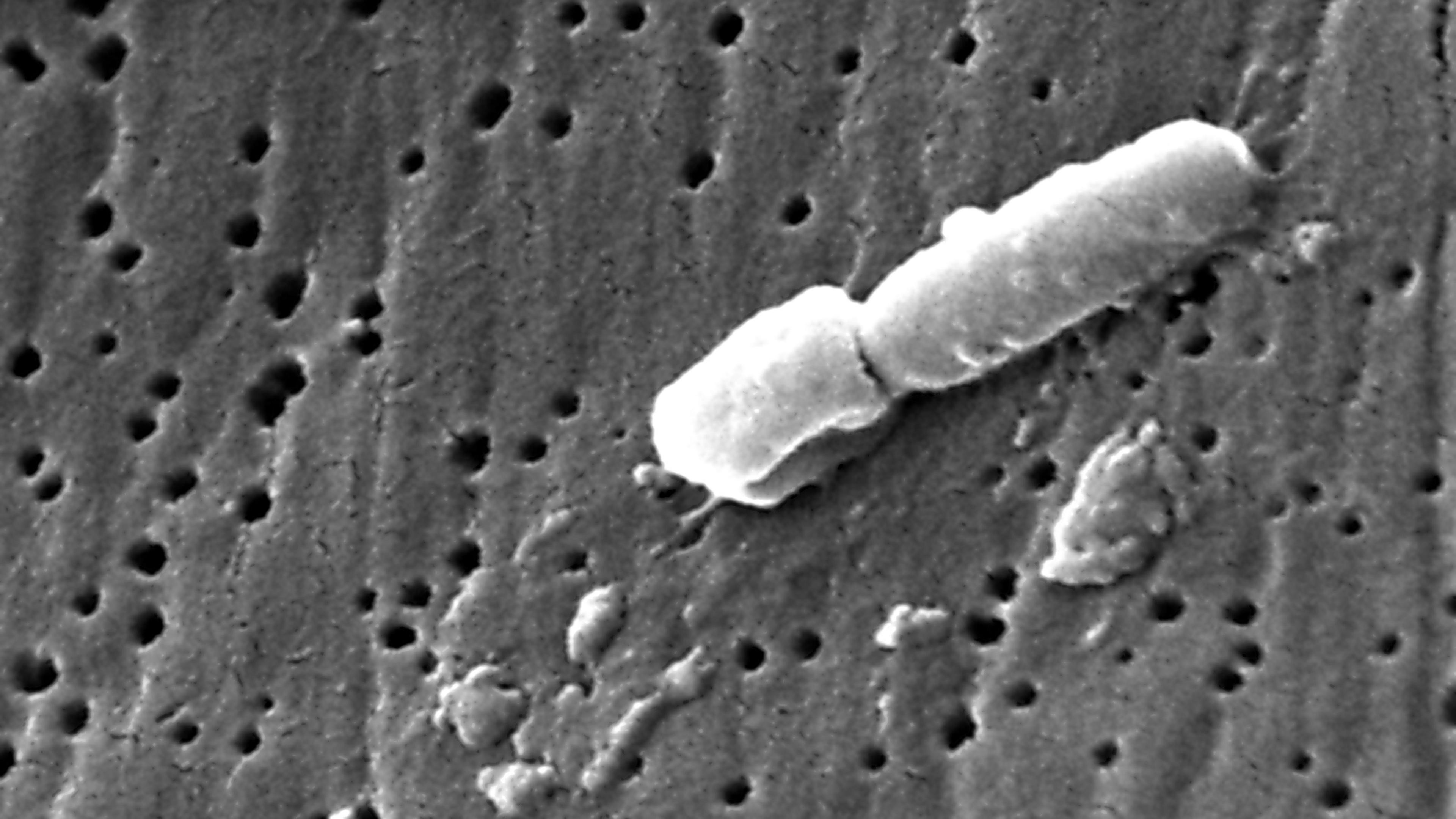  A Klebsiella pneumoniae bacterium seen in a scanning electron microscopic