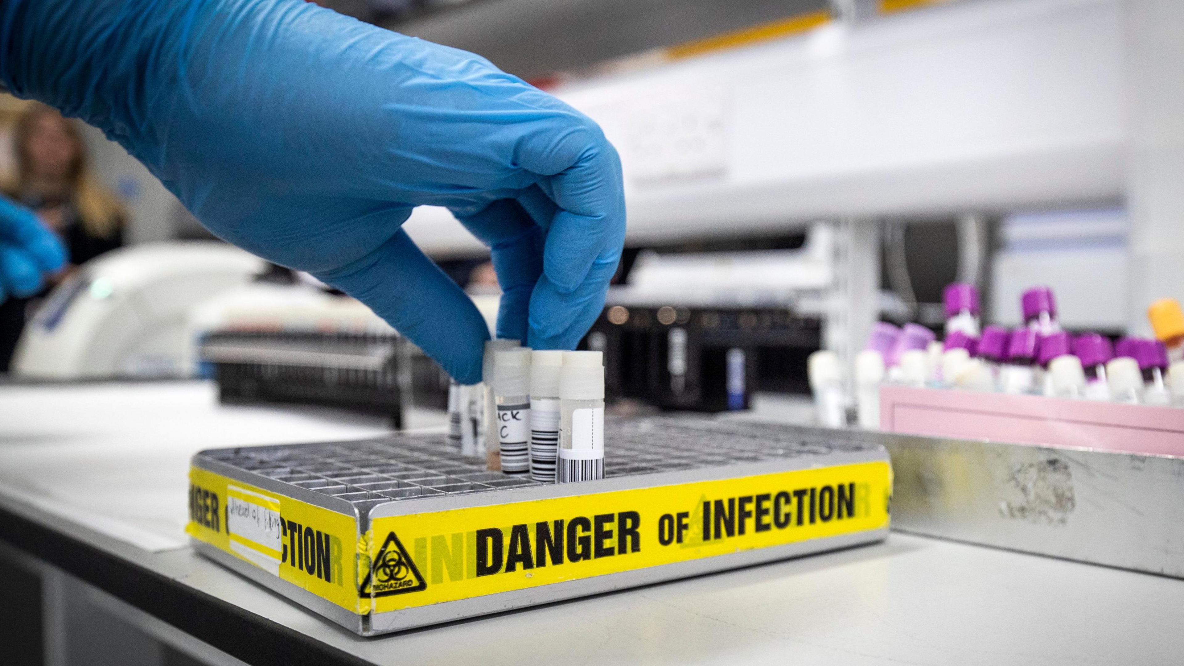 The gloved hand of a clinical support technician extracts viruses from swab samples so that the genetic structure of a virus can be analysed.  The tray of vials is labelled with yellow tape which warns "danger of infection". 