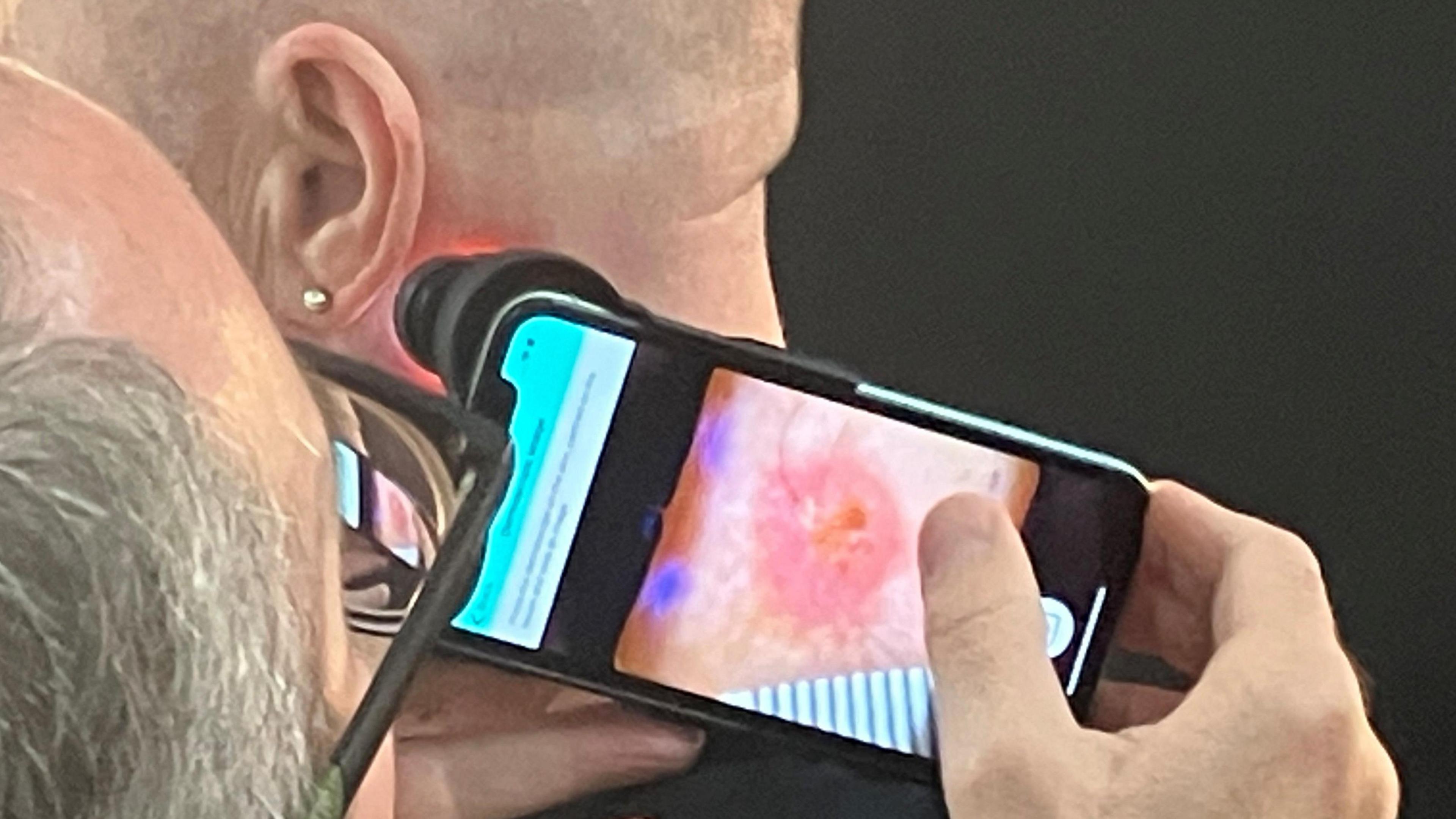 A clinical photographer taking a digital image of a patient's skin lesion which will be passed onto the consultant for their opinion diagnosis and if necessary treatment