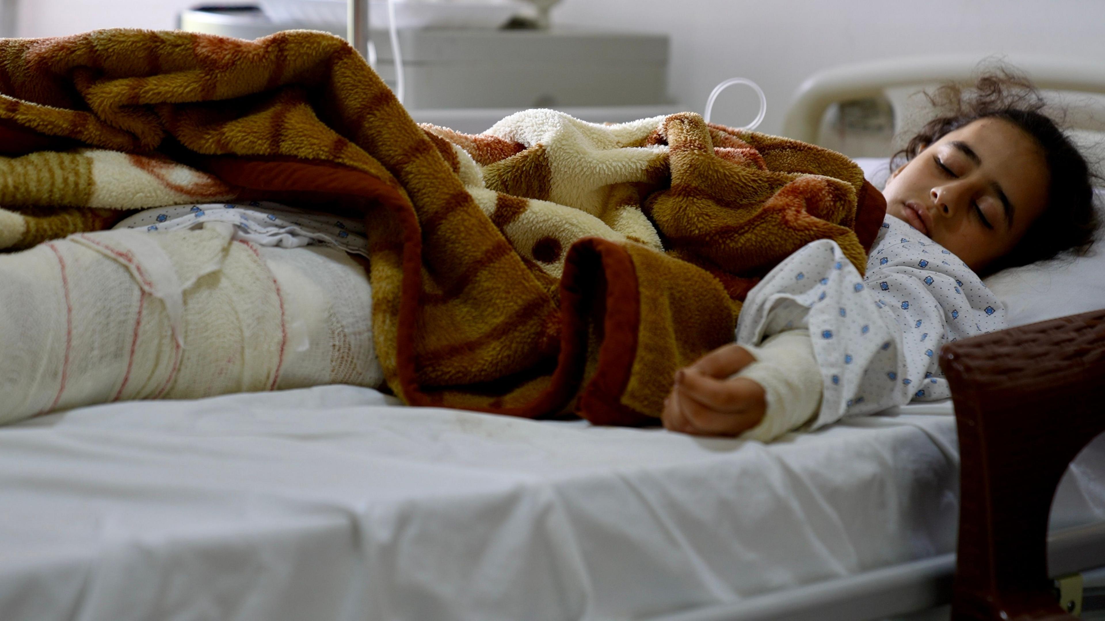 Mariam lies asleep in a hospital bed with a her left leg in a cast and arm heavily bandaged.