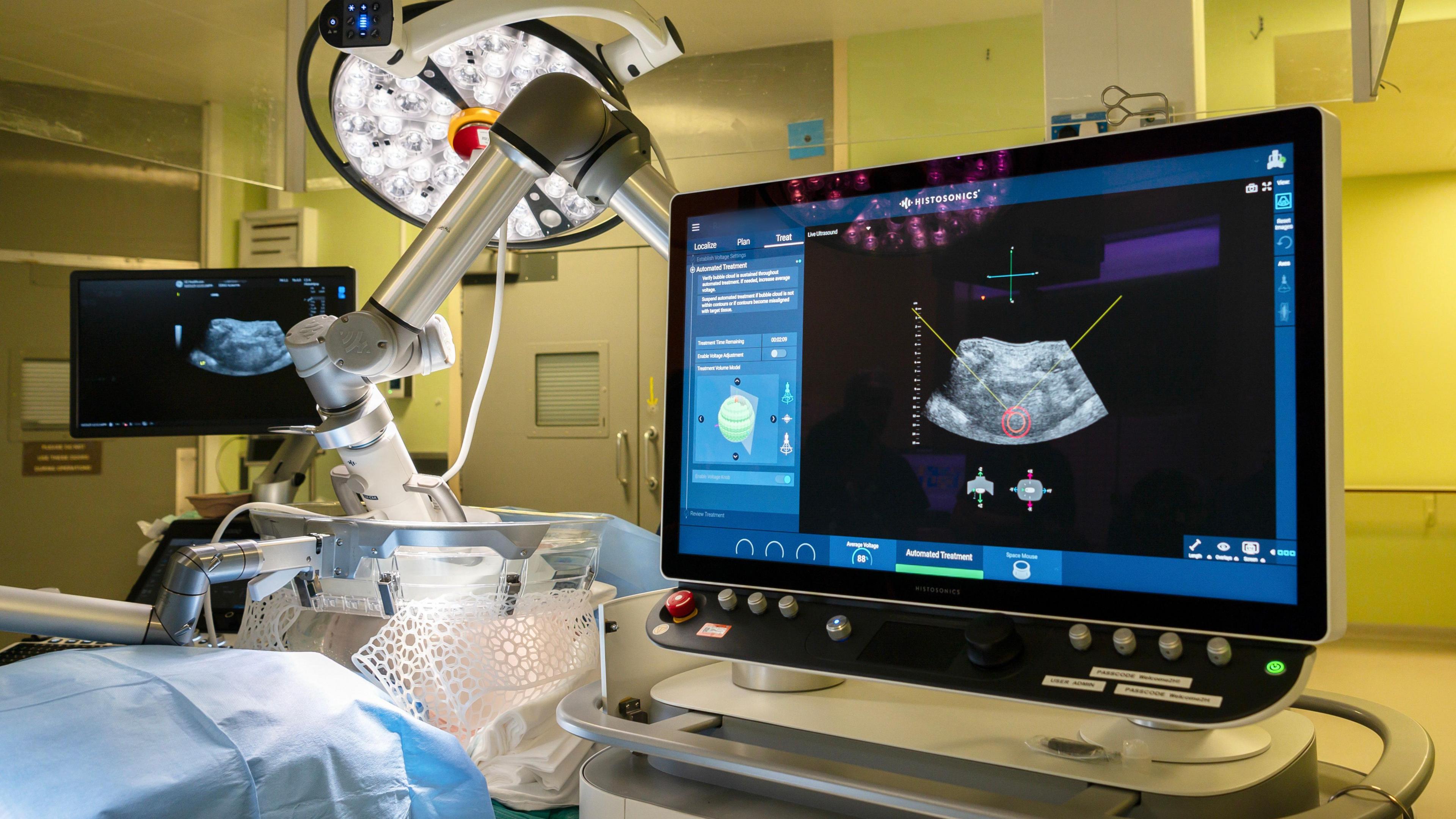 Inside the surgical suite is robotic-assisted equipment and advanced imaging systems. A large monitor displays a detailed 3D rendering that appears to be an ultrasound. A robotic arm with surgical instruments is positioned near the patient area.