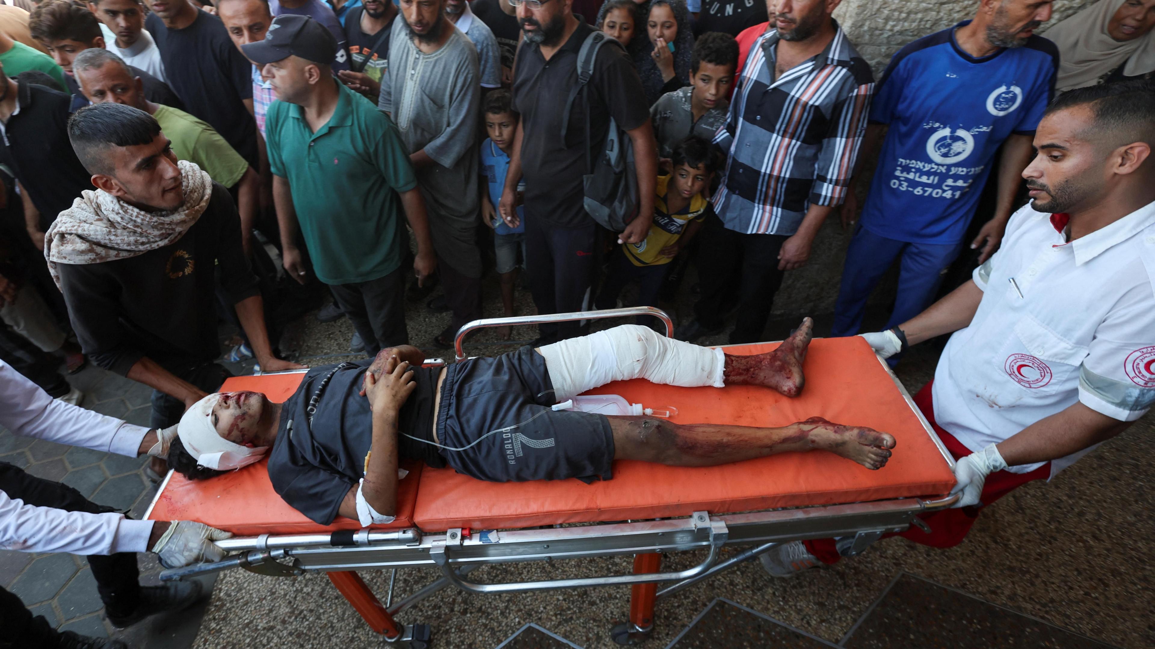 An injured Palestinian boy is brought to al-Aqsa hospital in Deir al-Balah after an Israeli air strike on a school sheltering displaced families in the central Gaza Strip (10 October 2024)