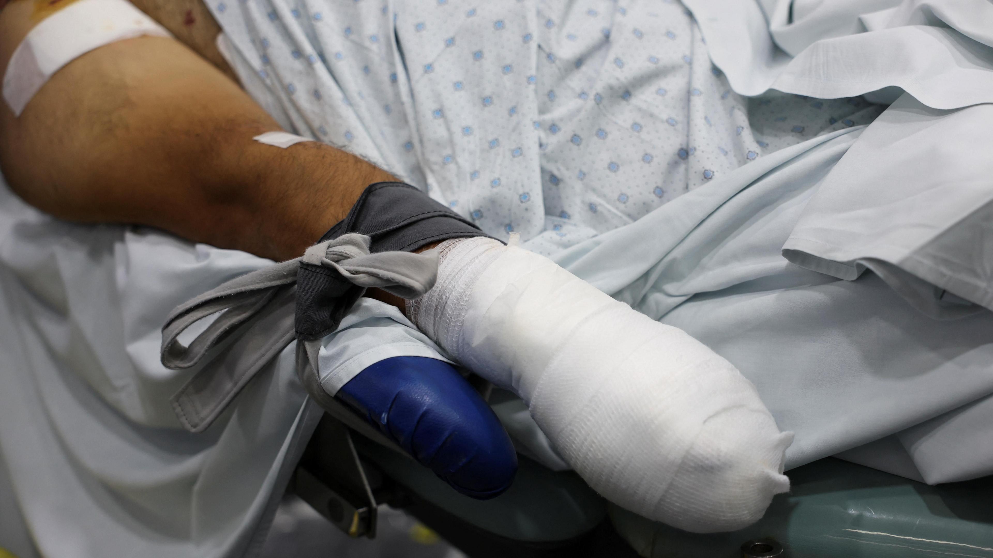 An injured man undergoes an operation in Beirut, Lebanon, after being injured by a pager explosion (18 September 2024)