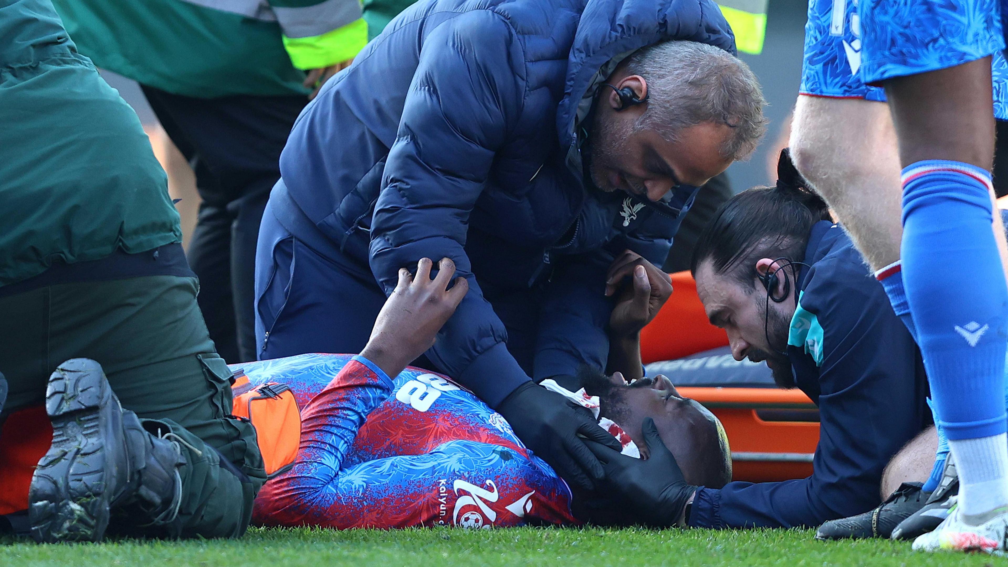 Jean-Philippe Mateta receives medical treatment on the pitch