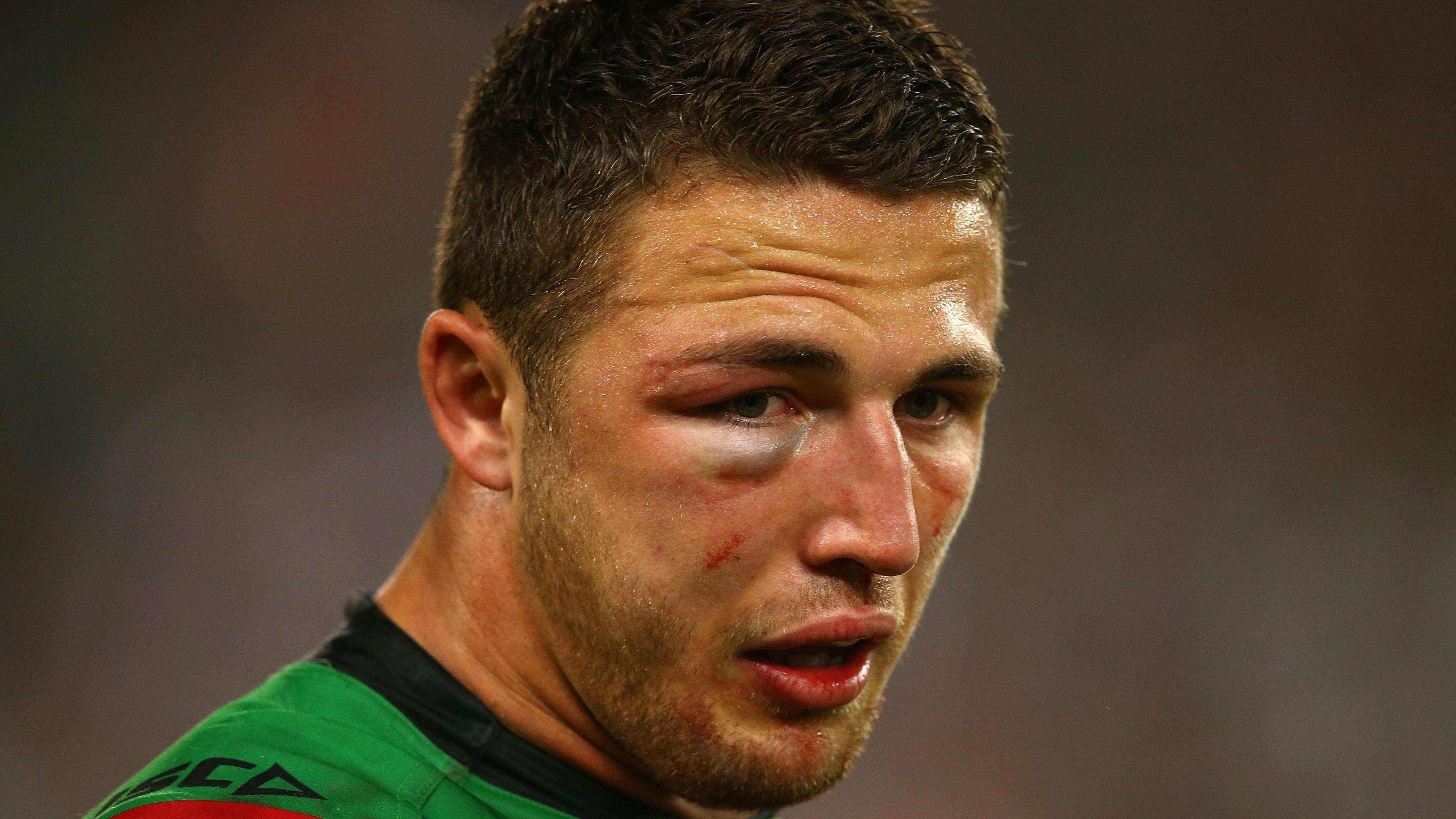 Sam Burgess' right eye puffs up after he broke it in a collision with England teammate James Graham during the 2014 NRL Grand Final for South Sydney against Canterbury.