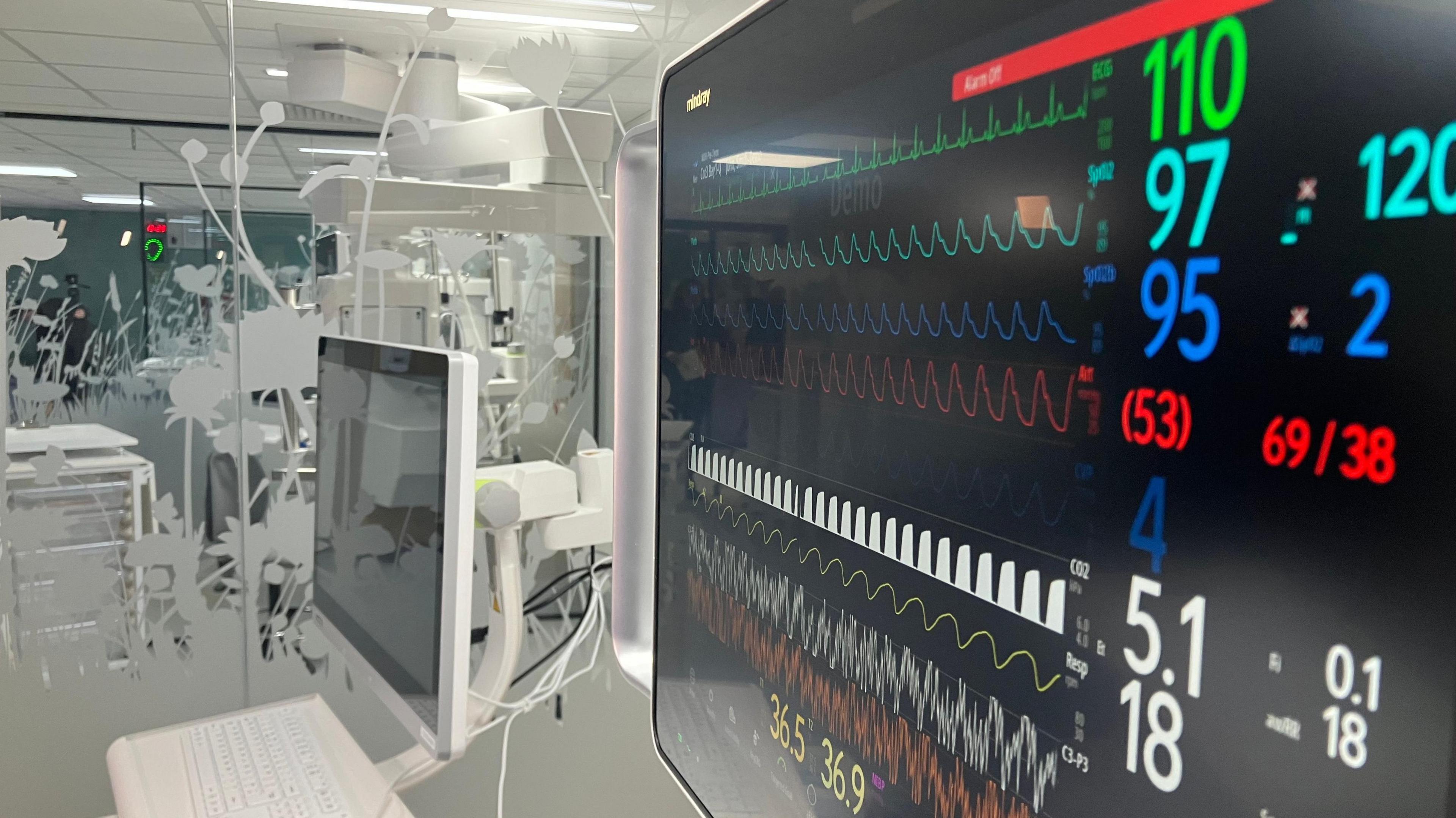 QMC neonatal baby unit. Computer screens showing an ECG machine can be seen in the foreground of the image