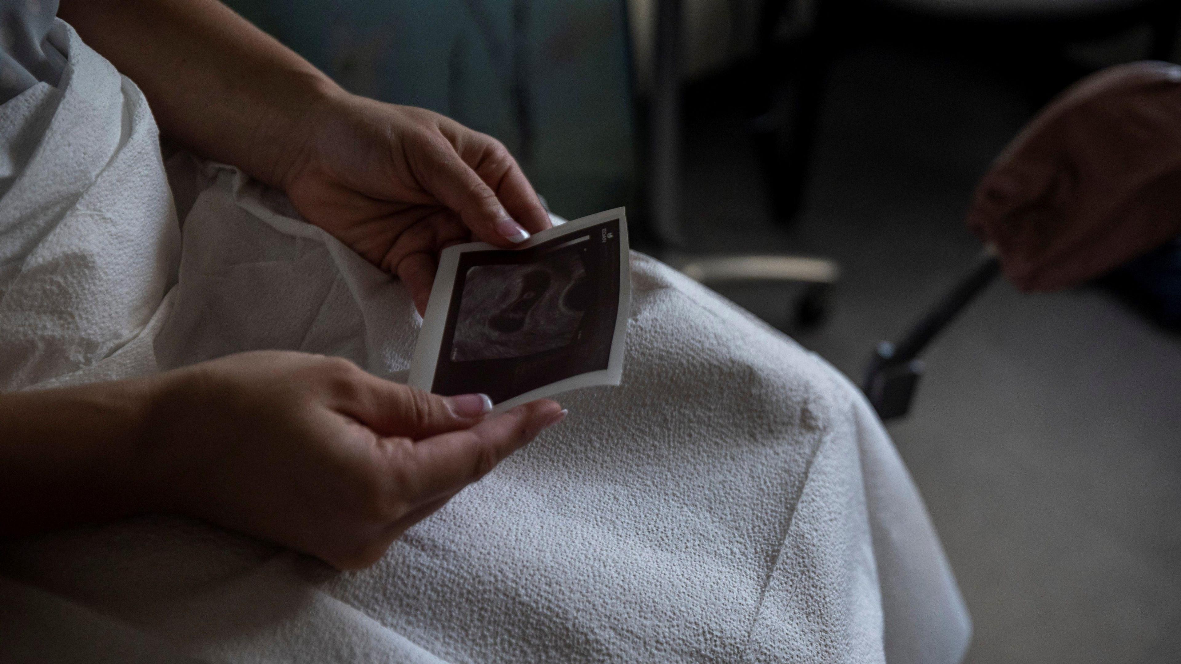 A woman's lap - sat in a hospital - with hands holding a pregnancy scan