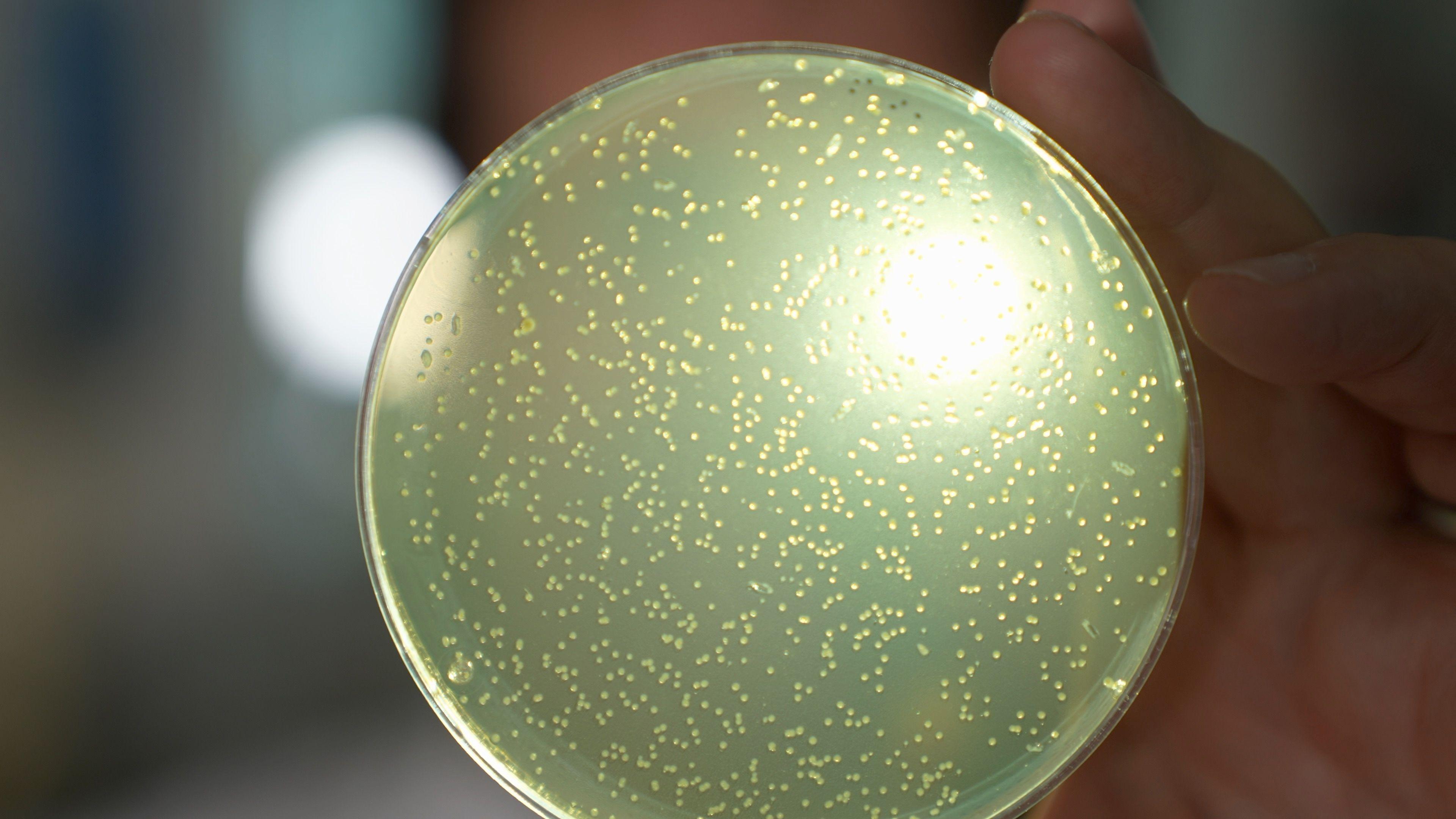 A petri dish lit up with a bright light with white spots of yeast.
