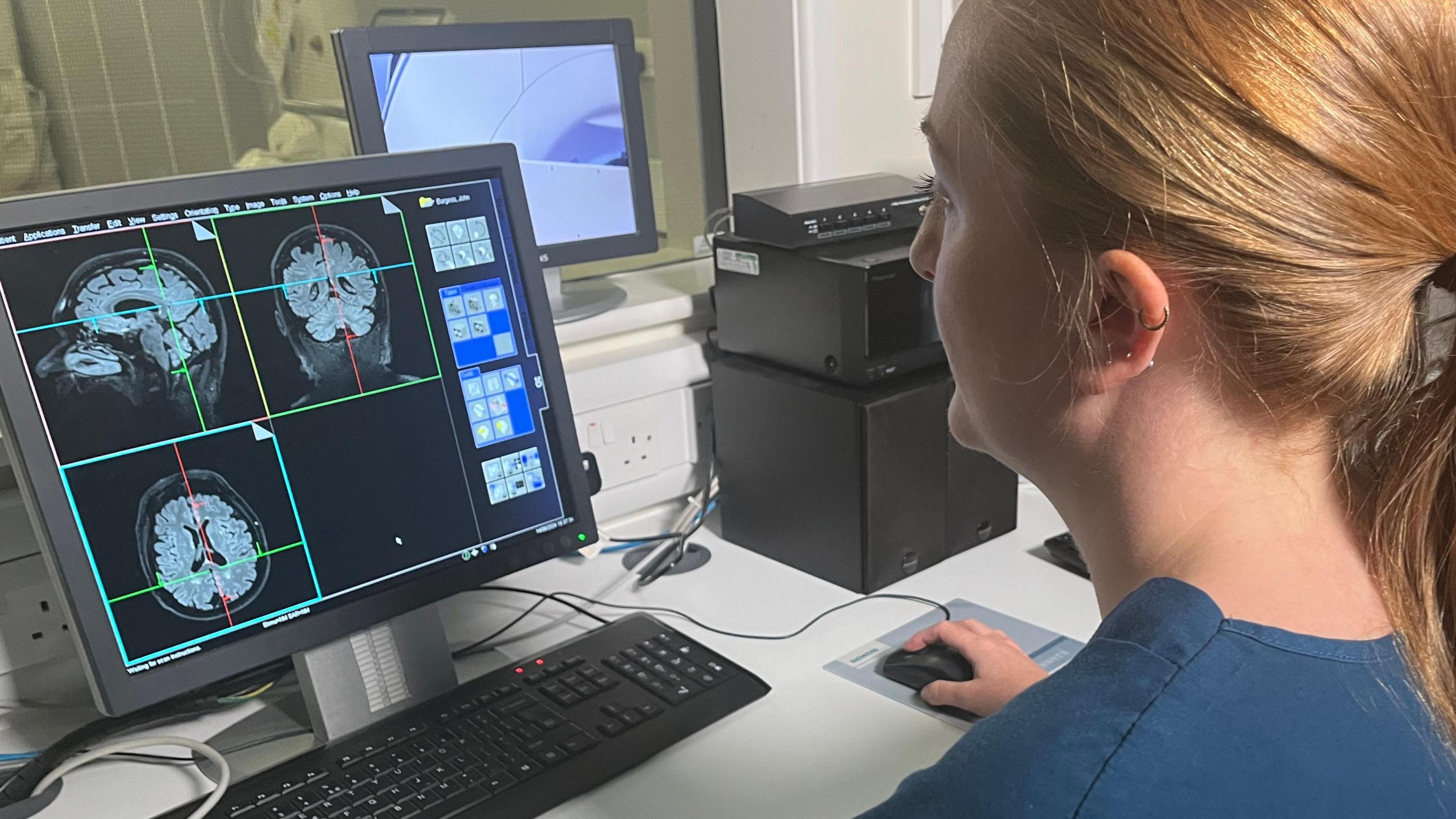 Researcher looking at brain scans on computer