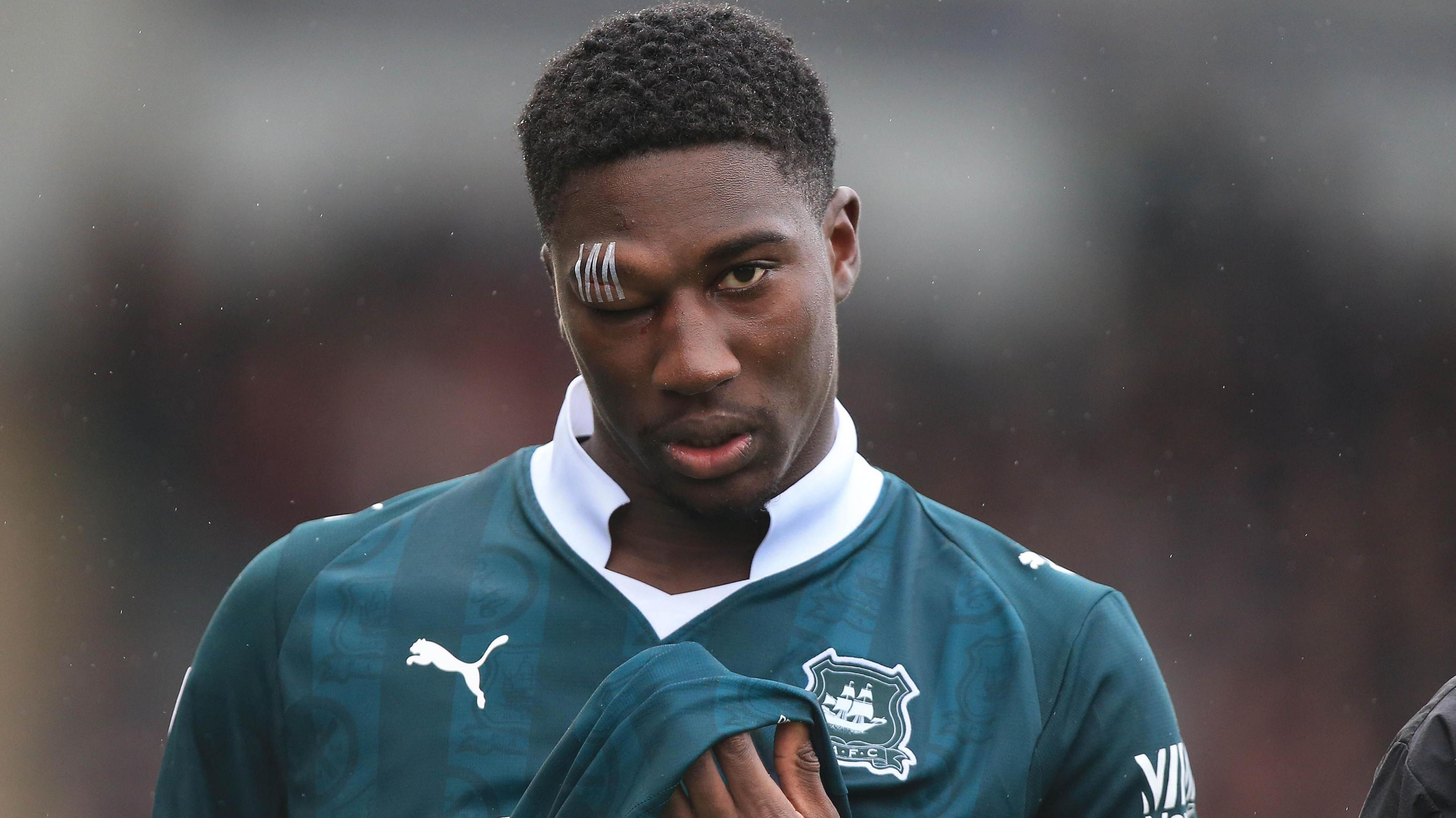 Bim Pepple with a swollen right eye