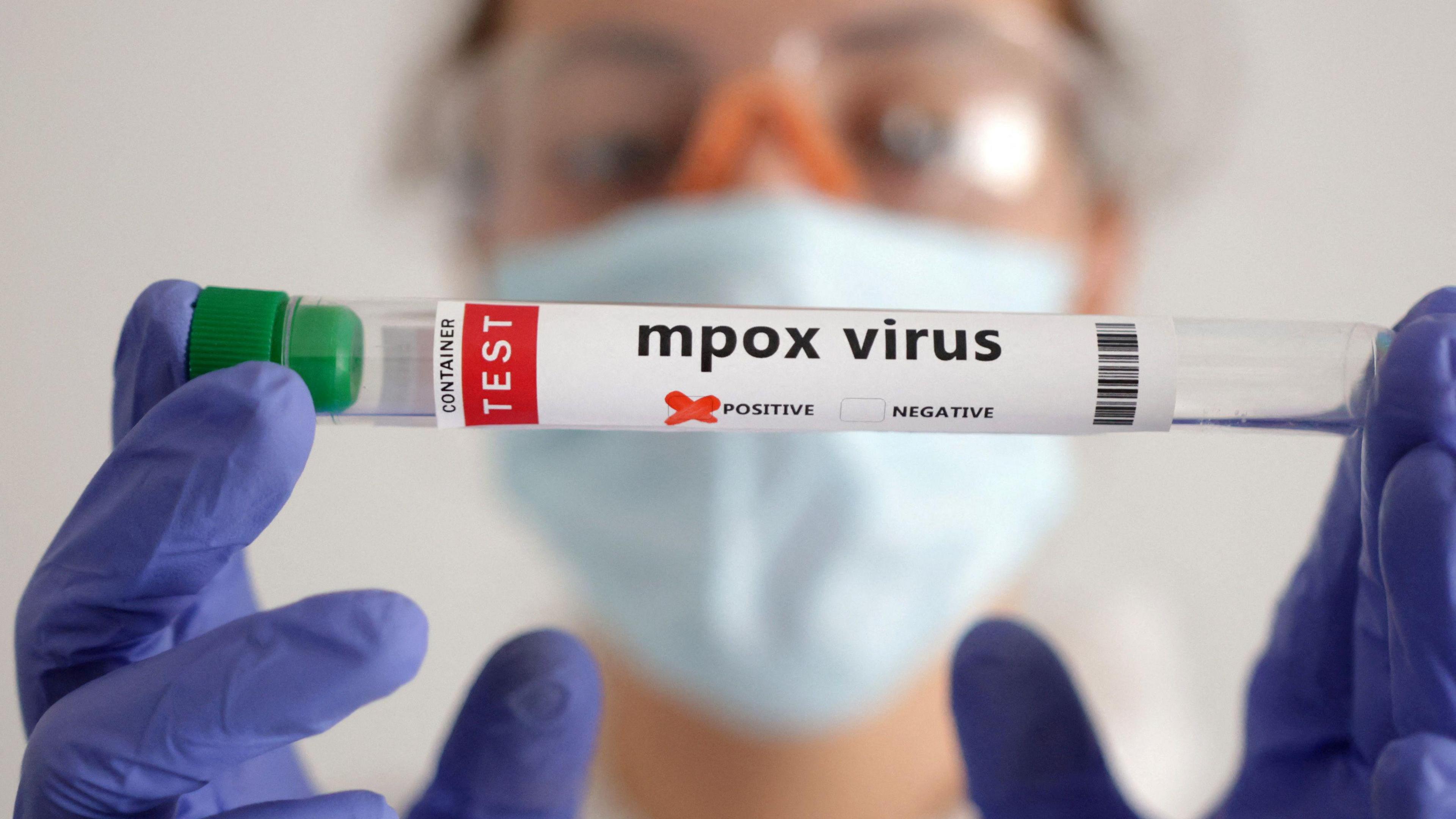 A woman wearing personal protective clothing including blue latex gloves, a light blue face mask and goggles holding a tube containing a positive mpox virus sample.