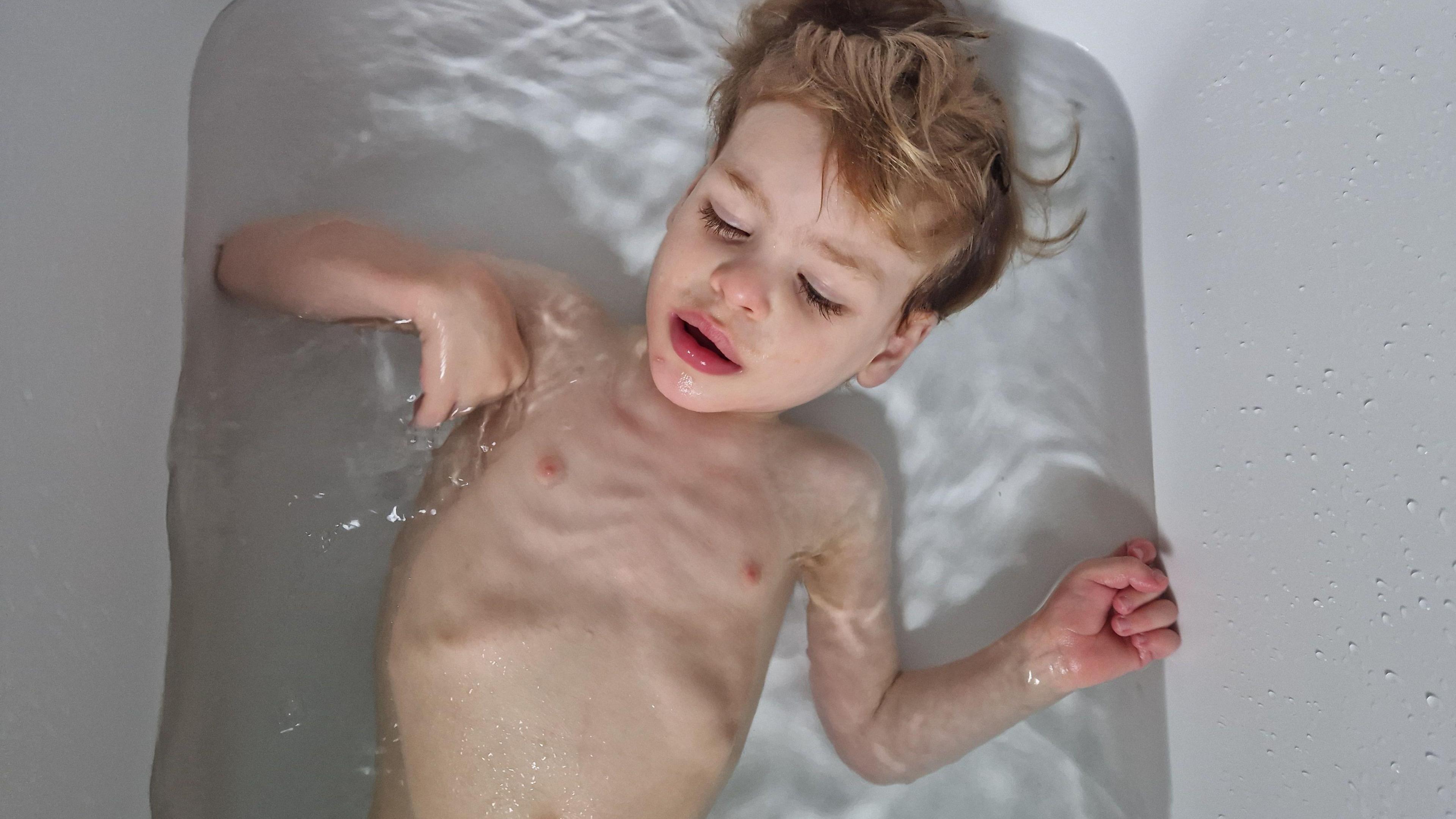 Ivan lying down in a bath of water showing signs of being underweight. He is a young boy with blonde hair.