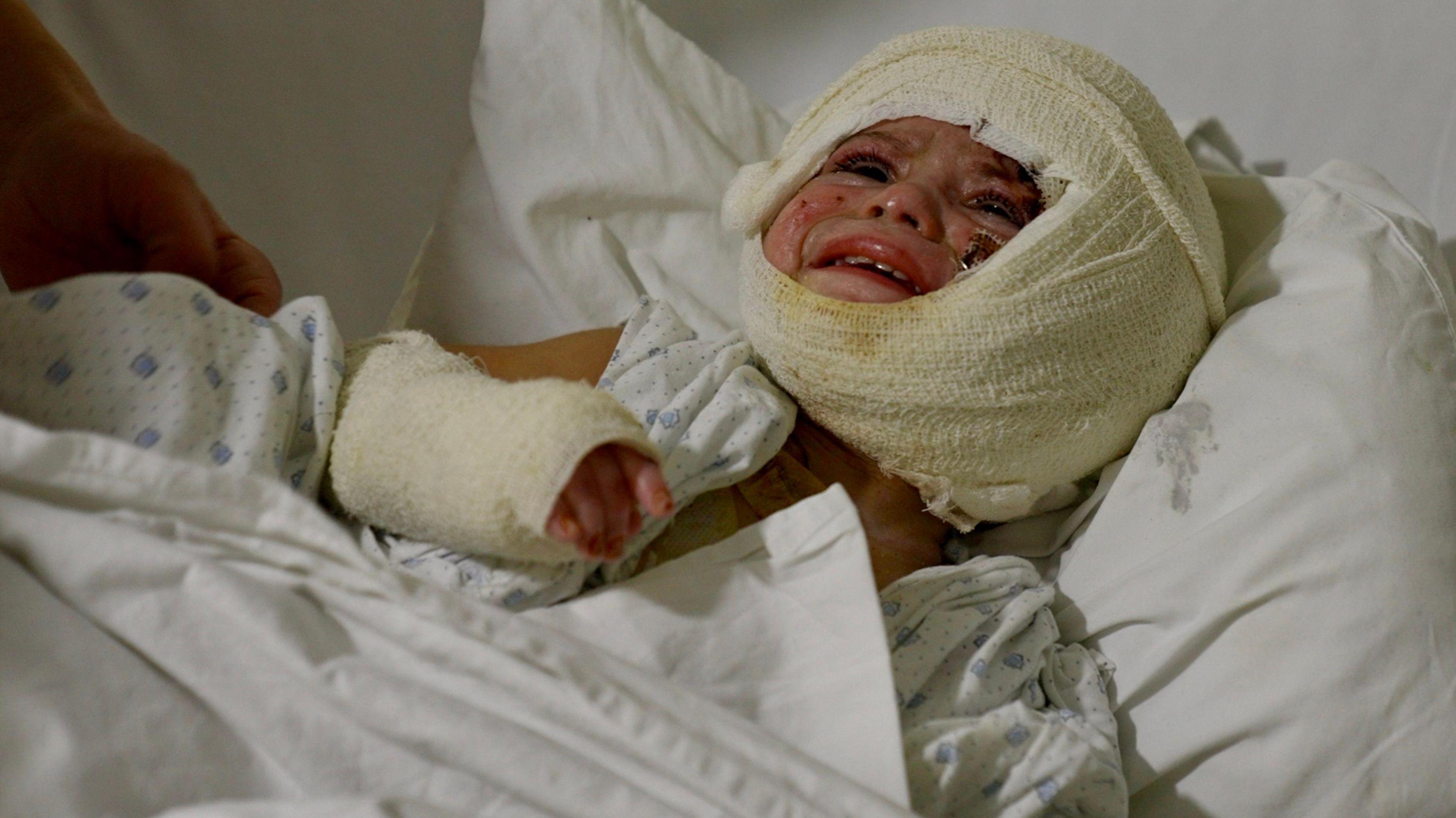 A young child lies on a hospital bed, heavily bandaged around her head and face and hand