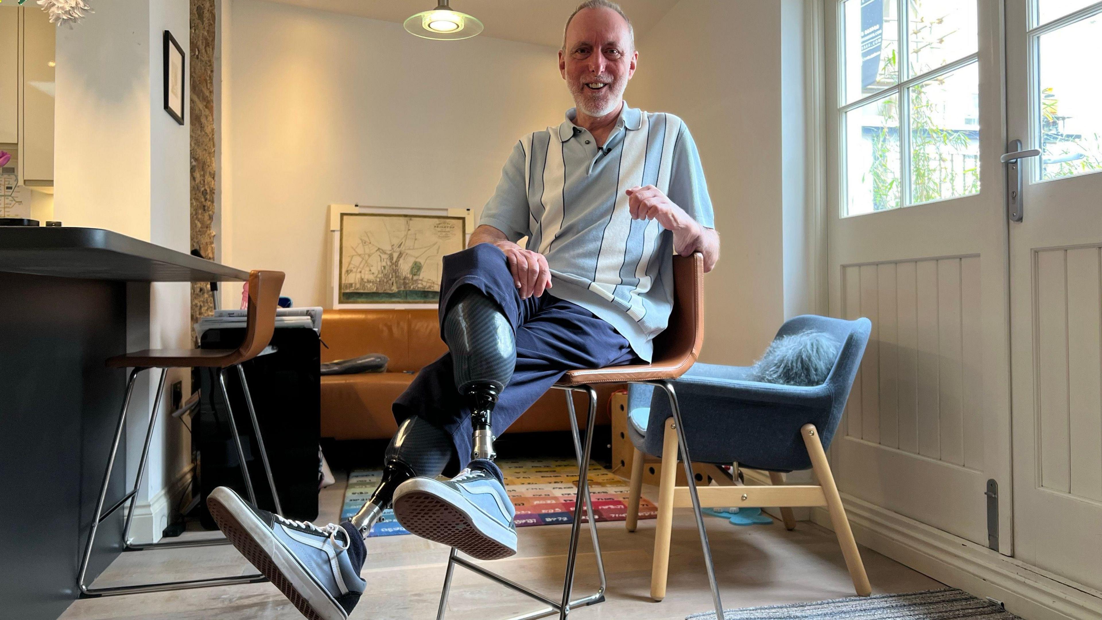 Mike Davies with his prosthetic feet