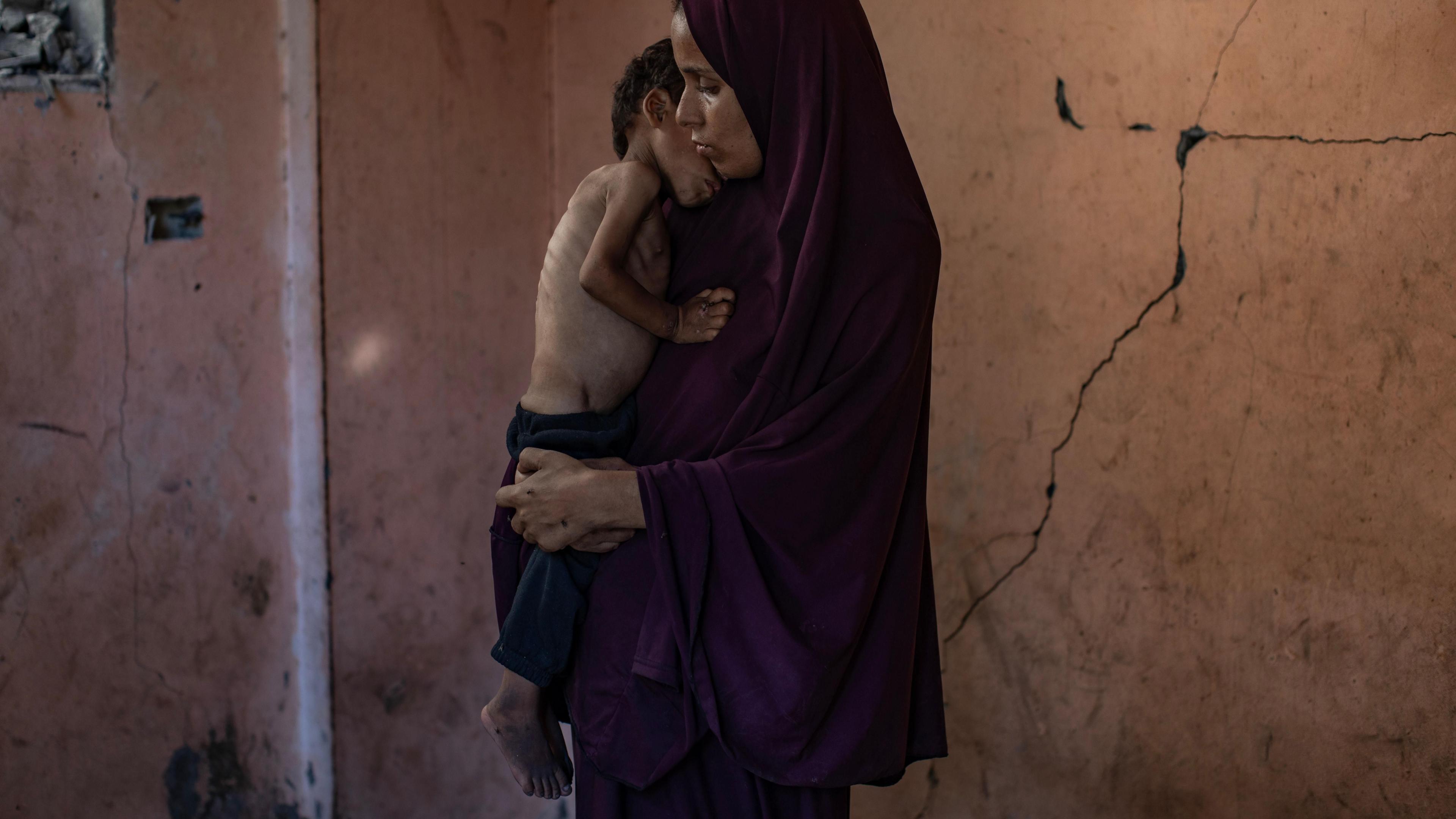A mother dressed in plum-coloured clothing stands holding her child, who is severely thin. The bones of his ribcage and hips are visible. They are in front of a cracked orange wall.