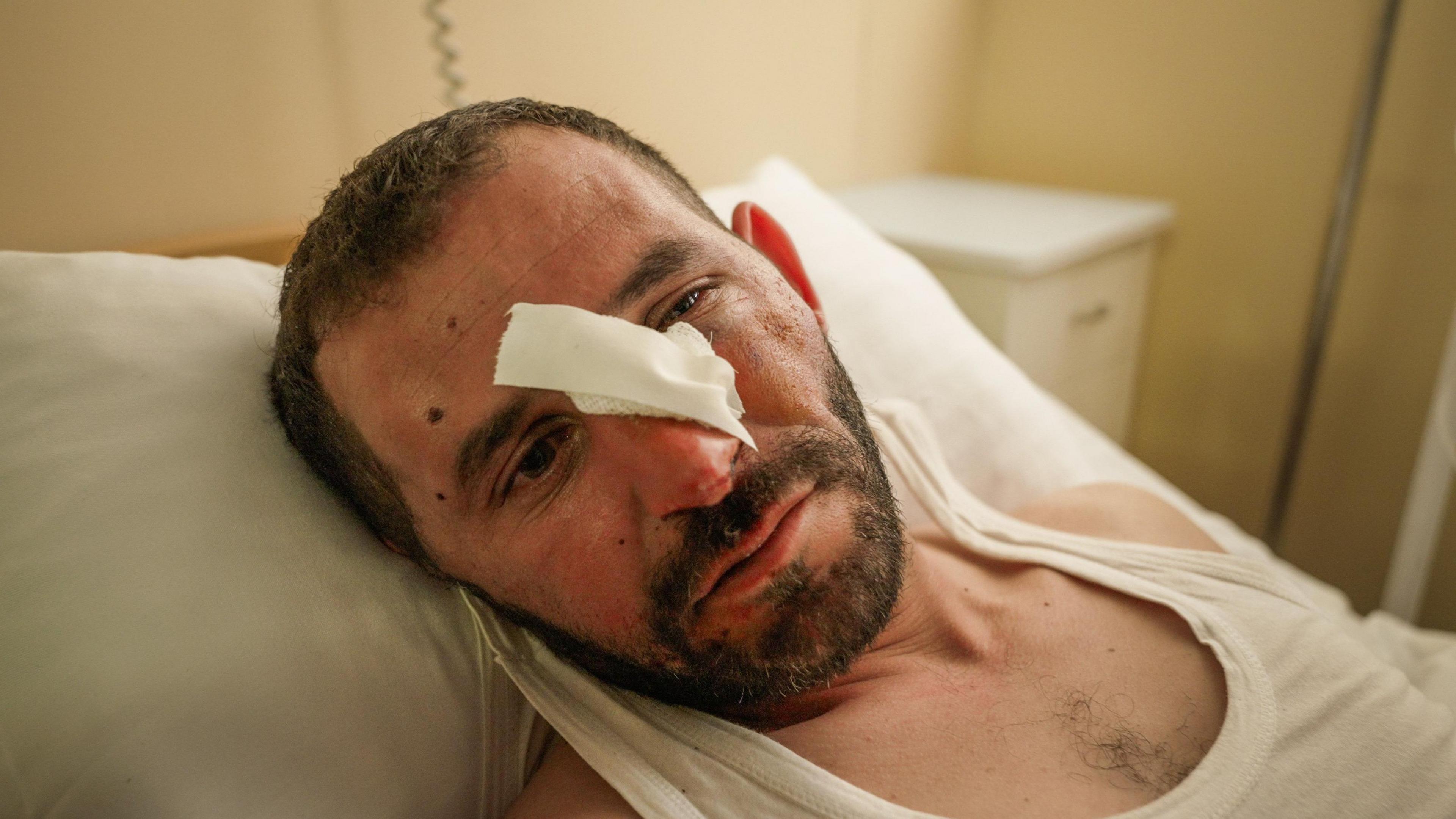 Azat Karimov, 35, was beaten up in Marneuli