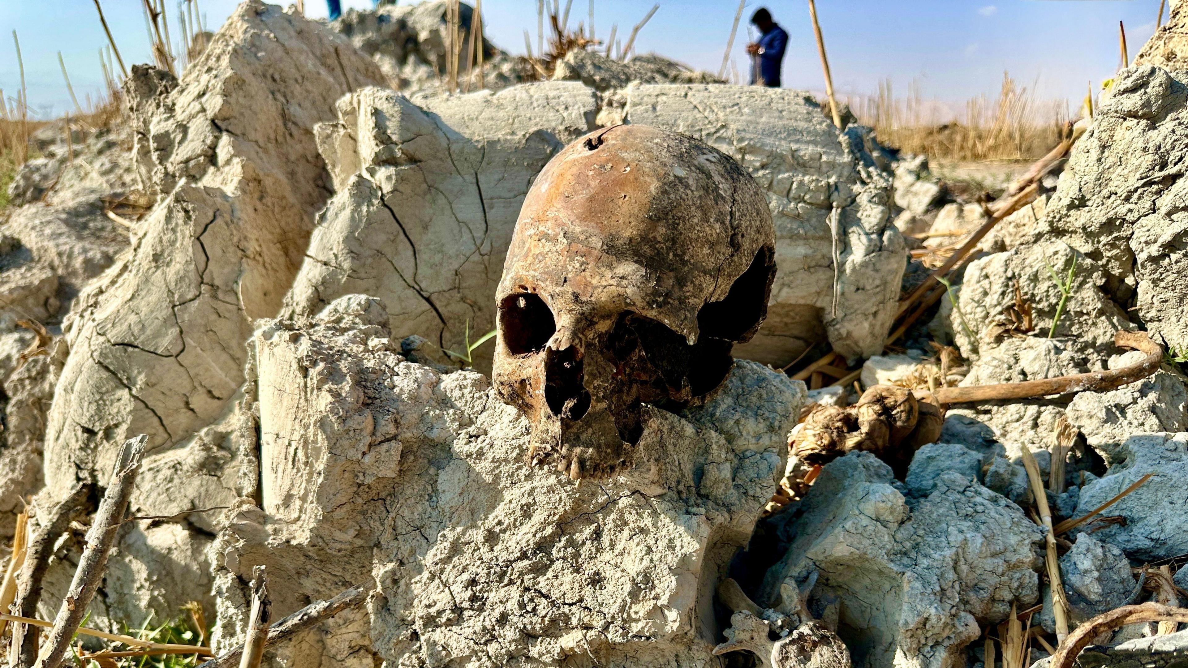 A damaged human skull is seen on clods of dry soil
