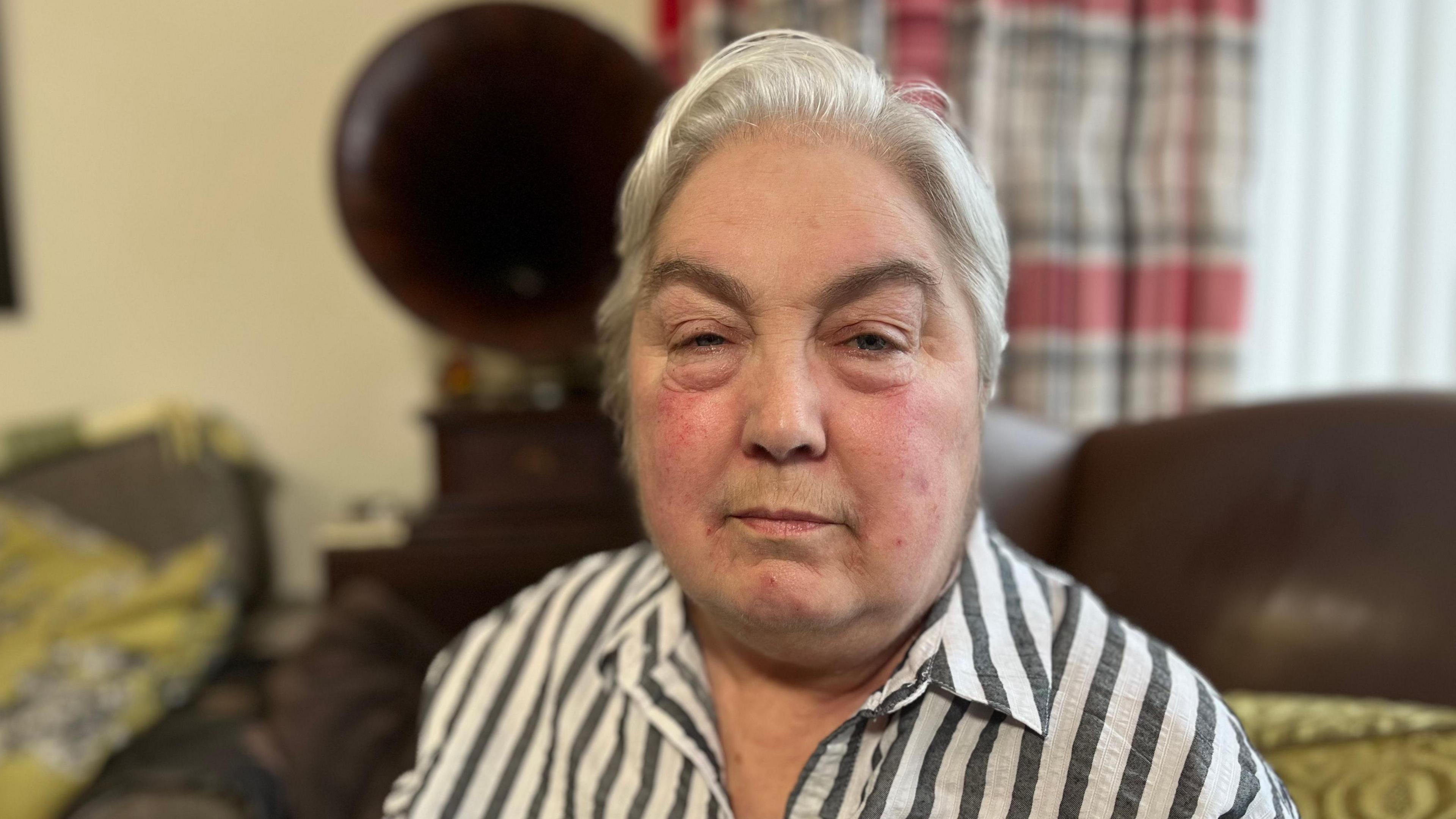 A woman looking straight ahead. She has short, grey hair and is wearing a white and grey striped shirt.