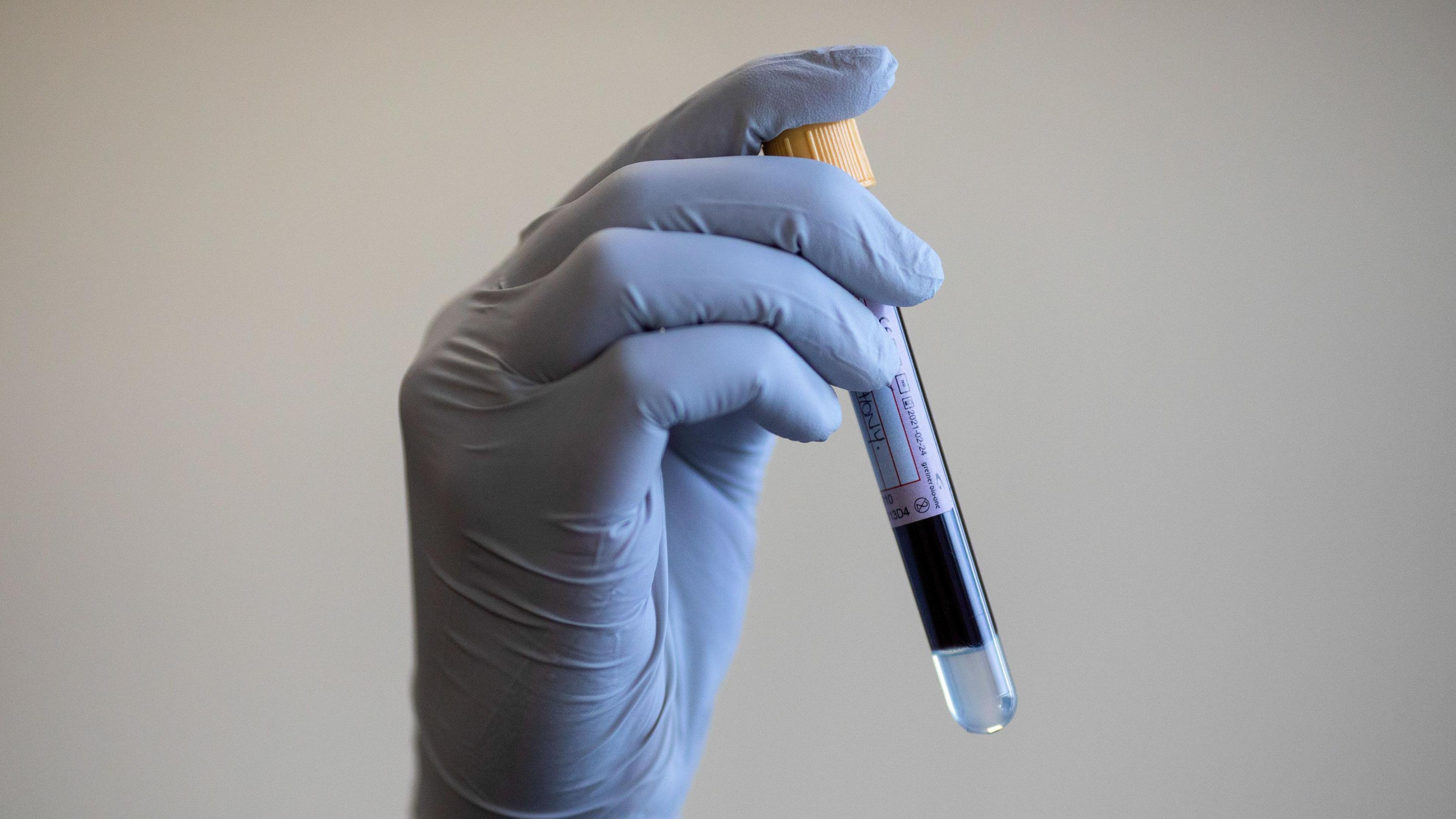 A blue rubber gloved hand holds up a glass tube with a blood sample in it.