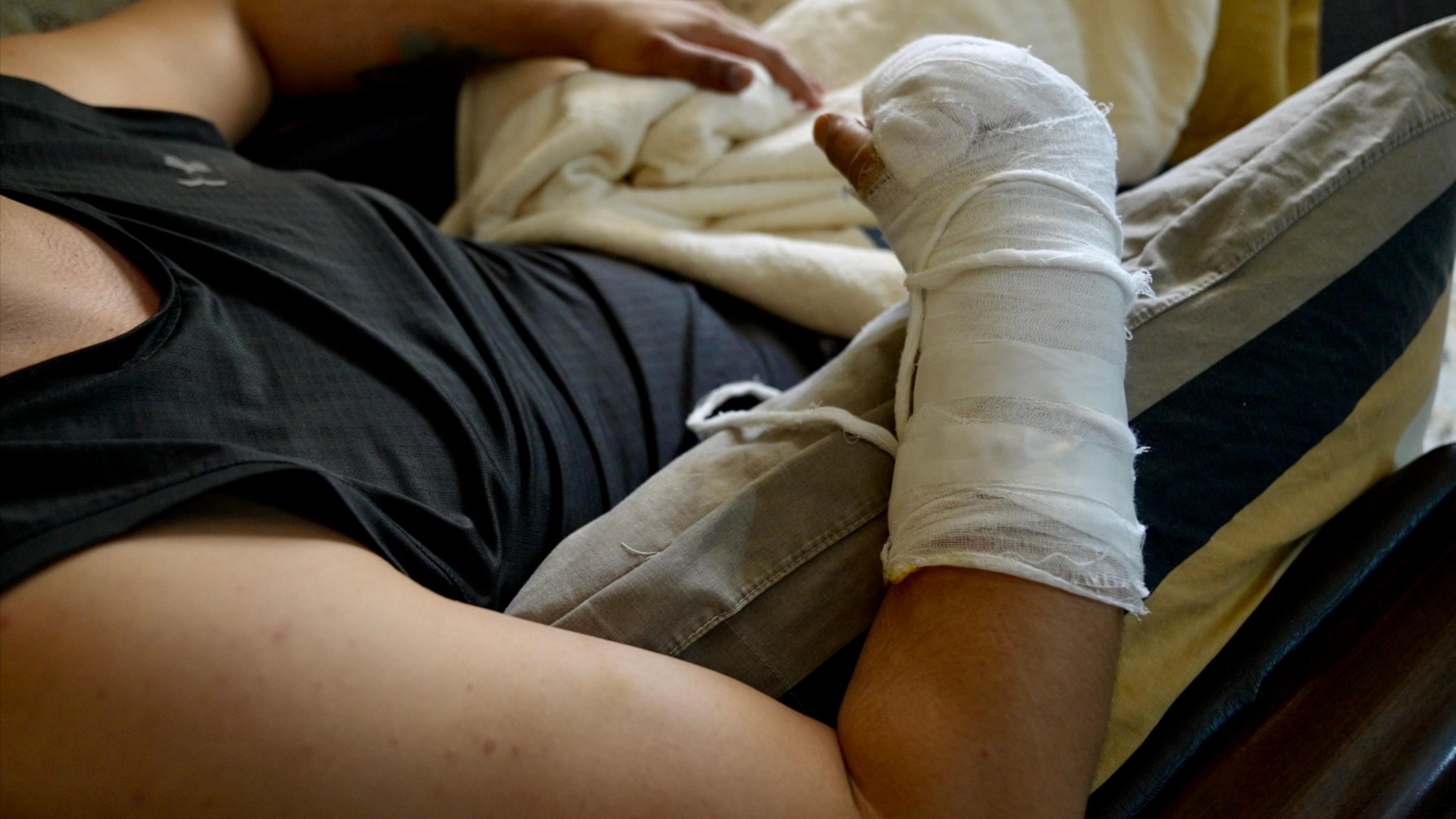 The lone survivor of the attack shows bandages on his arm and hand
