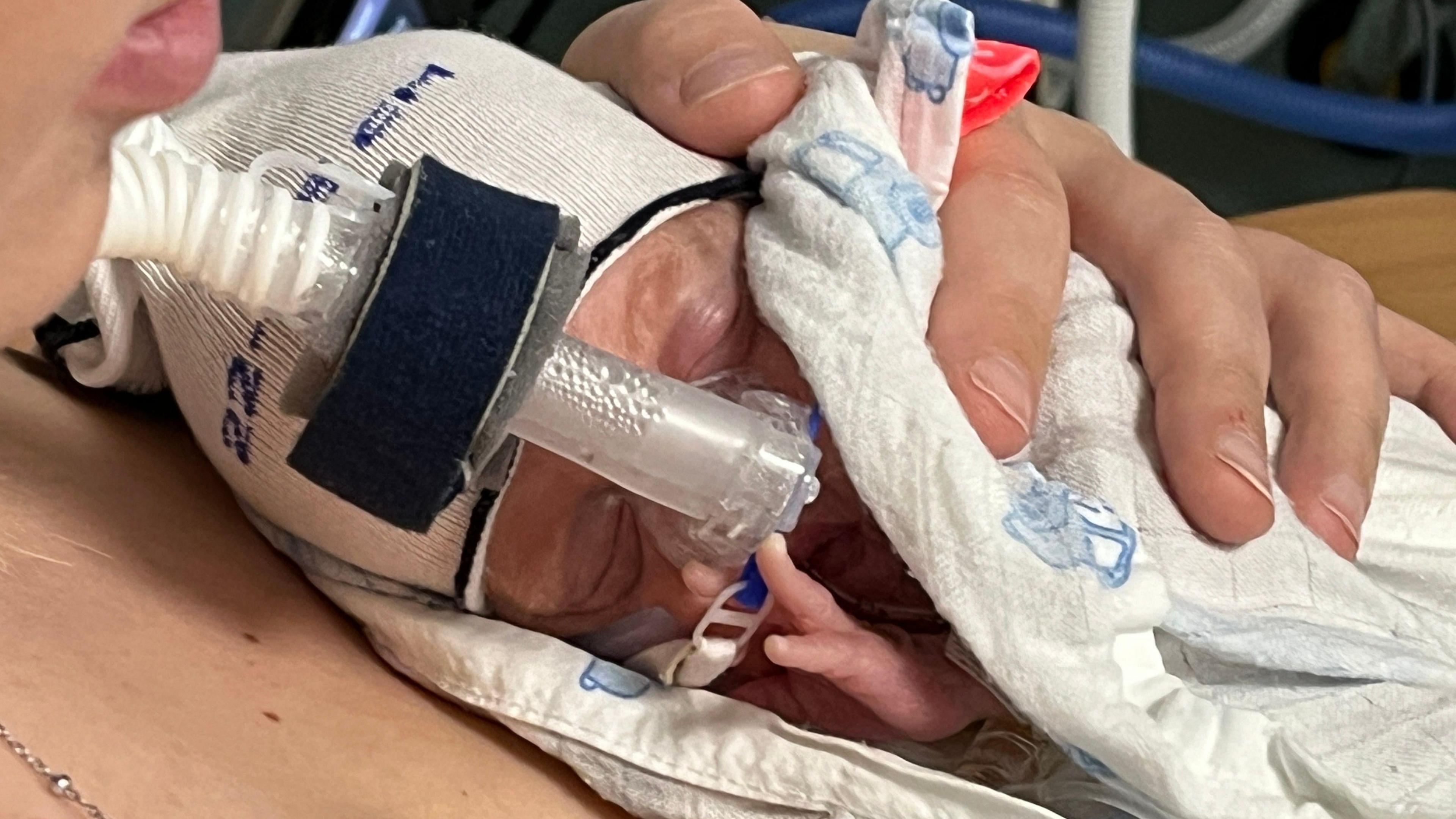 Zachary, a tiny baby born prematurely, is wrapped in a muslin, wearing a knitted cap and fitted with a ventilator. He is being held on his mother's chest, her hand wrapped around him.