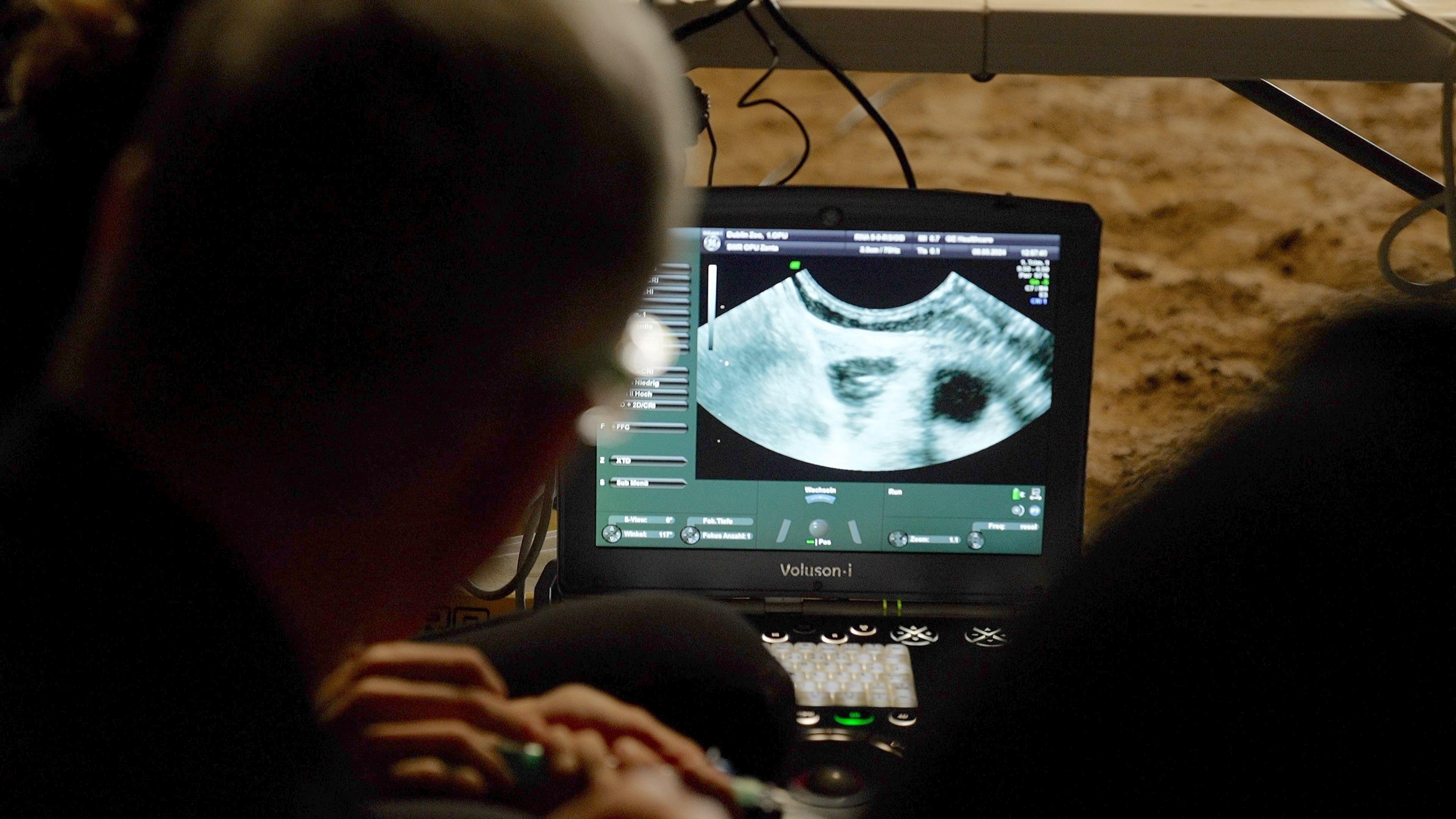 Ultrasound of Zanta the rhino