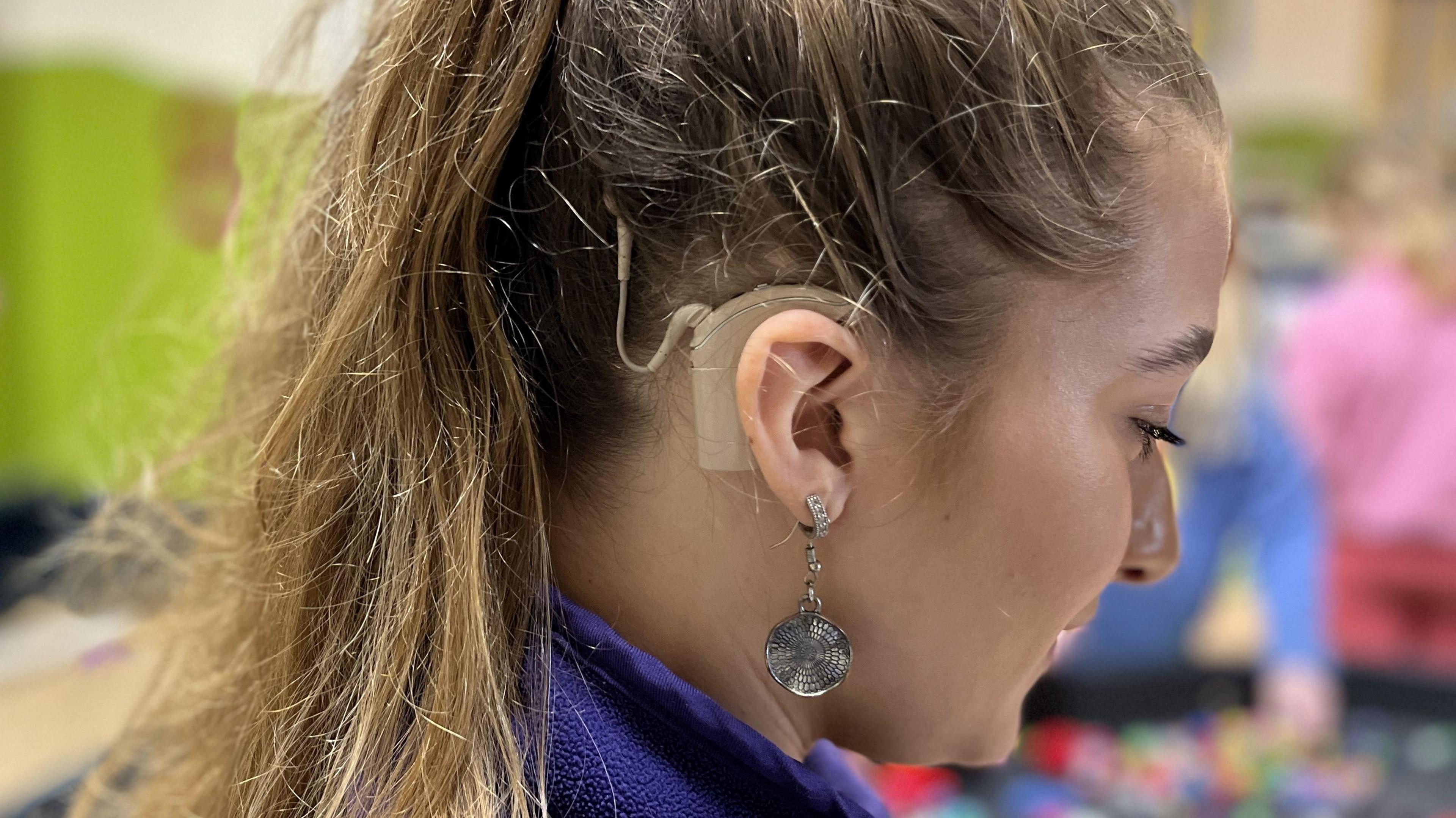 Topaz Oram with her hair tied up to show the cochlear implant on the right side of her head