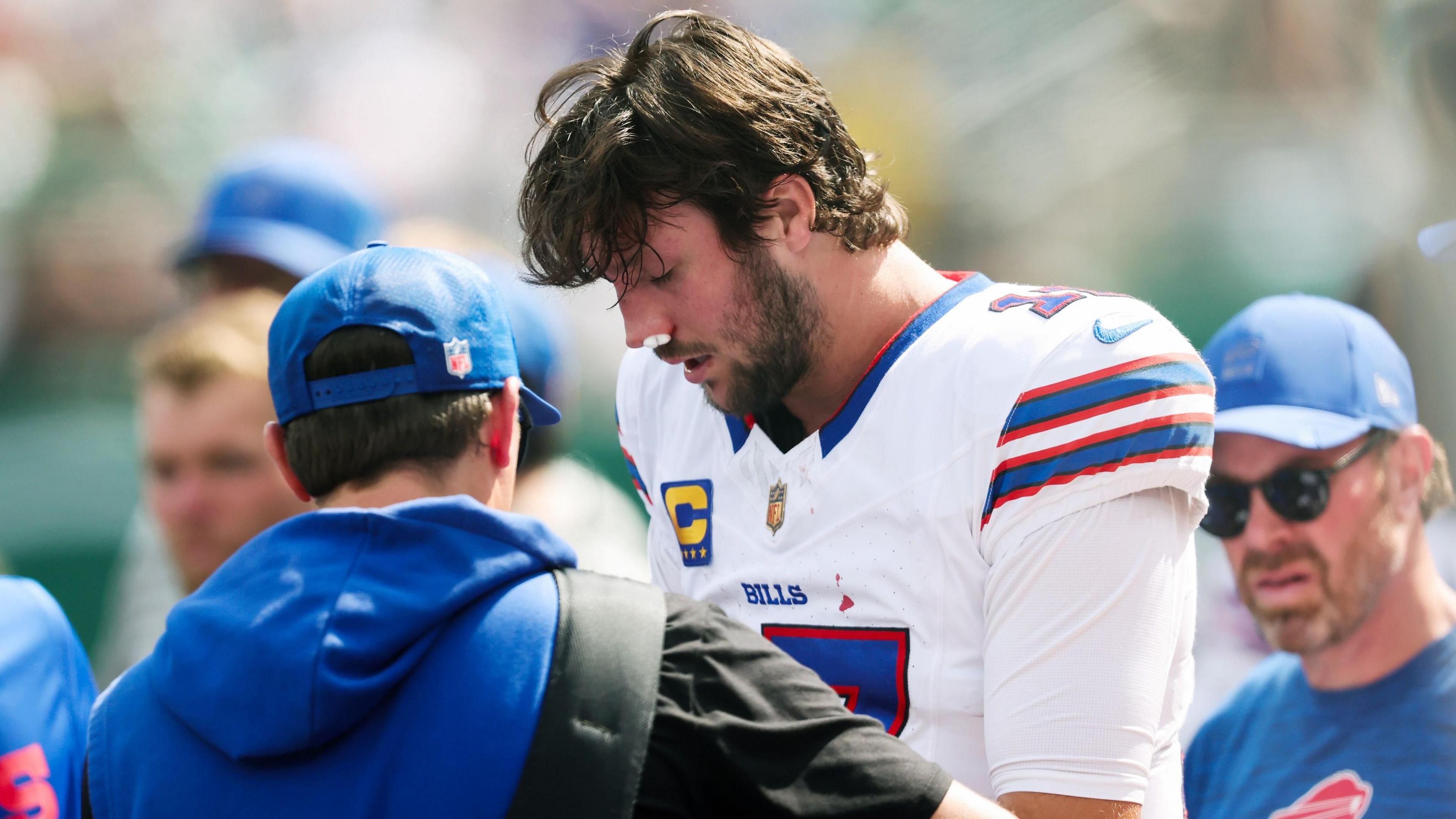 Bufalo Bills backmost Josh Allen gets curen for a chemoreceptor injury