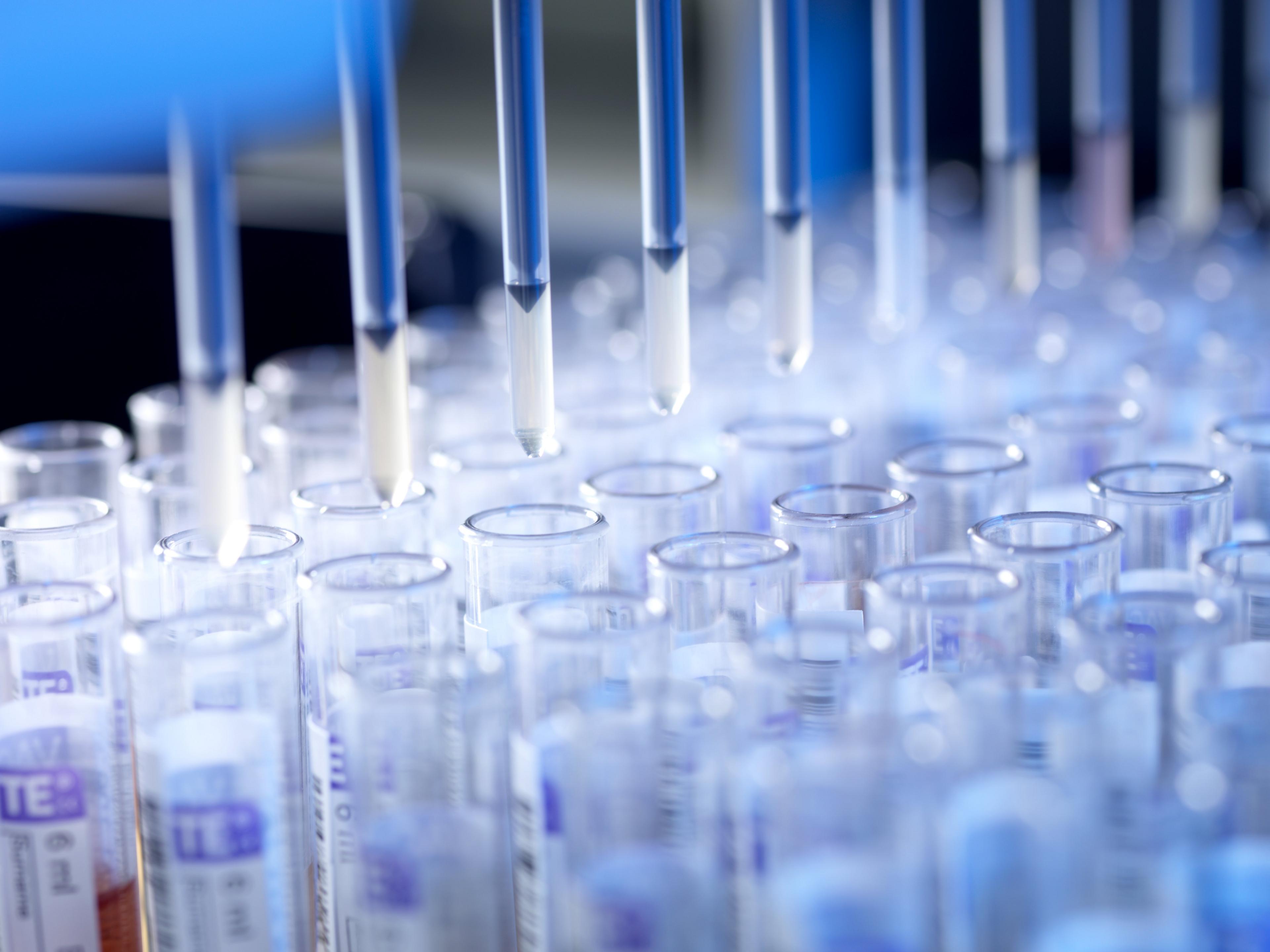 Pipettes hover over test tubes below