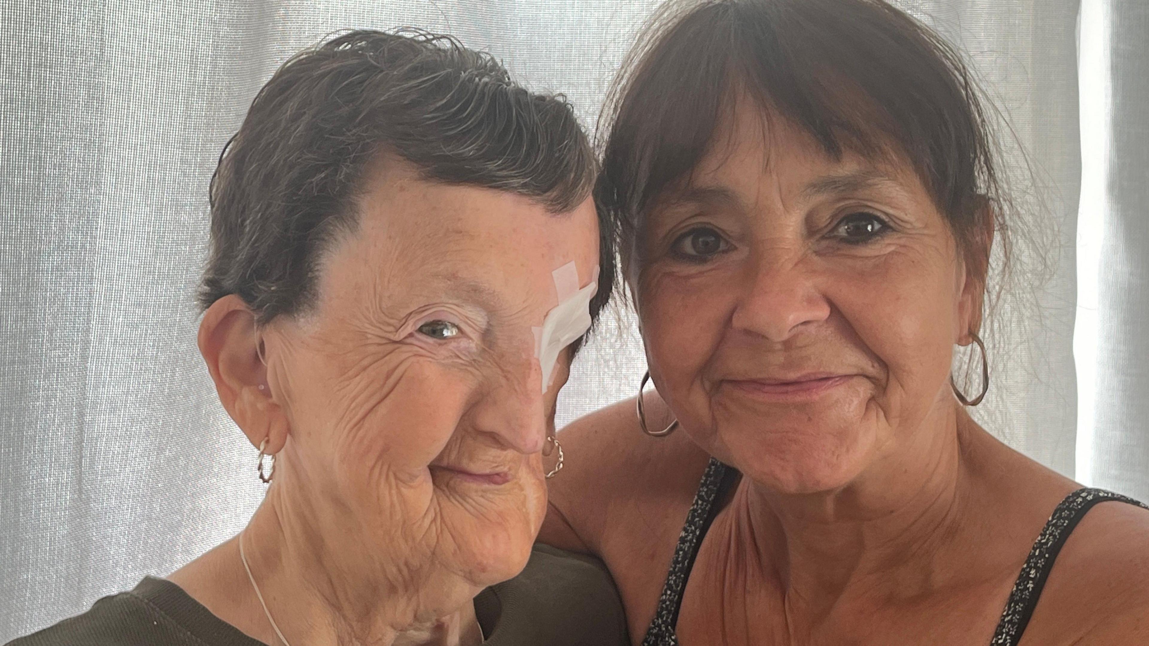 Rosie Burrows  and her daughter Julie Donoghue. Rosie has a patch over her left eye.