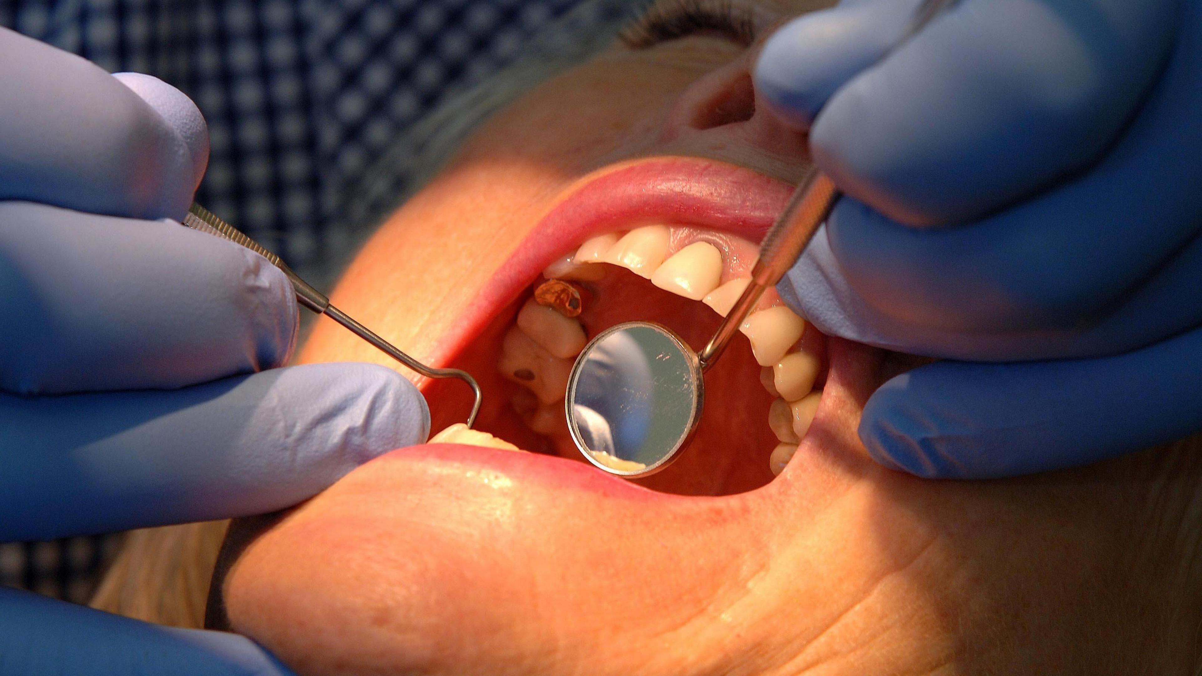 A woman is having her teeth examined by a dentist wearing blue plastic gloves.