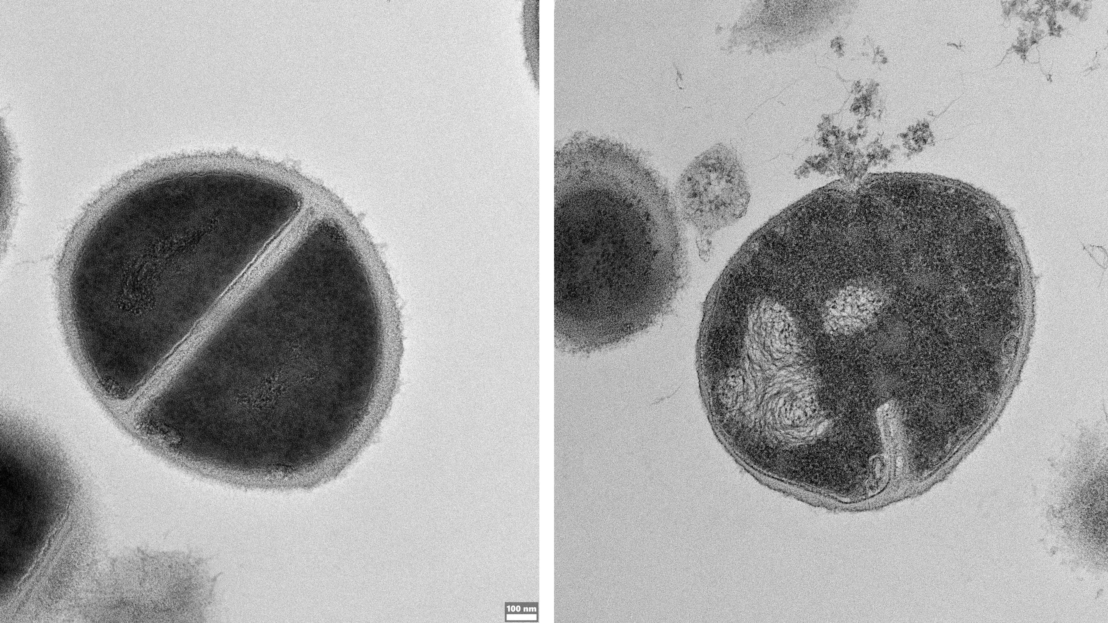 Two side by side pictures of bacteria under a microscope, one is healthy and one is rupturing and leaking it's contents.