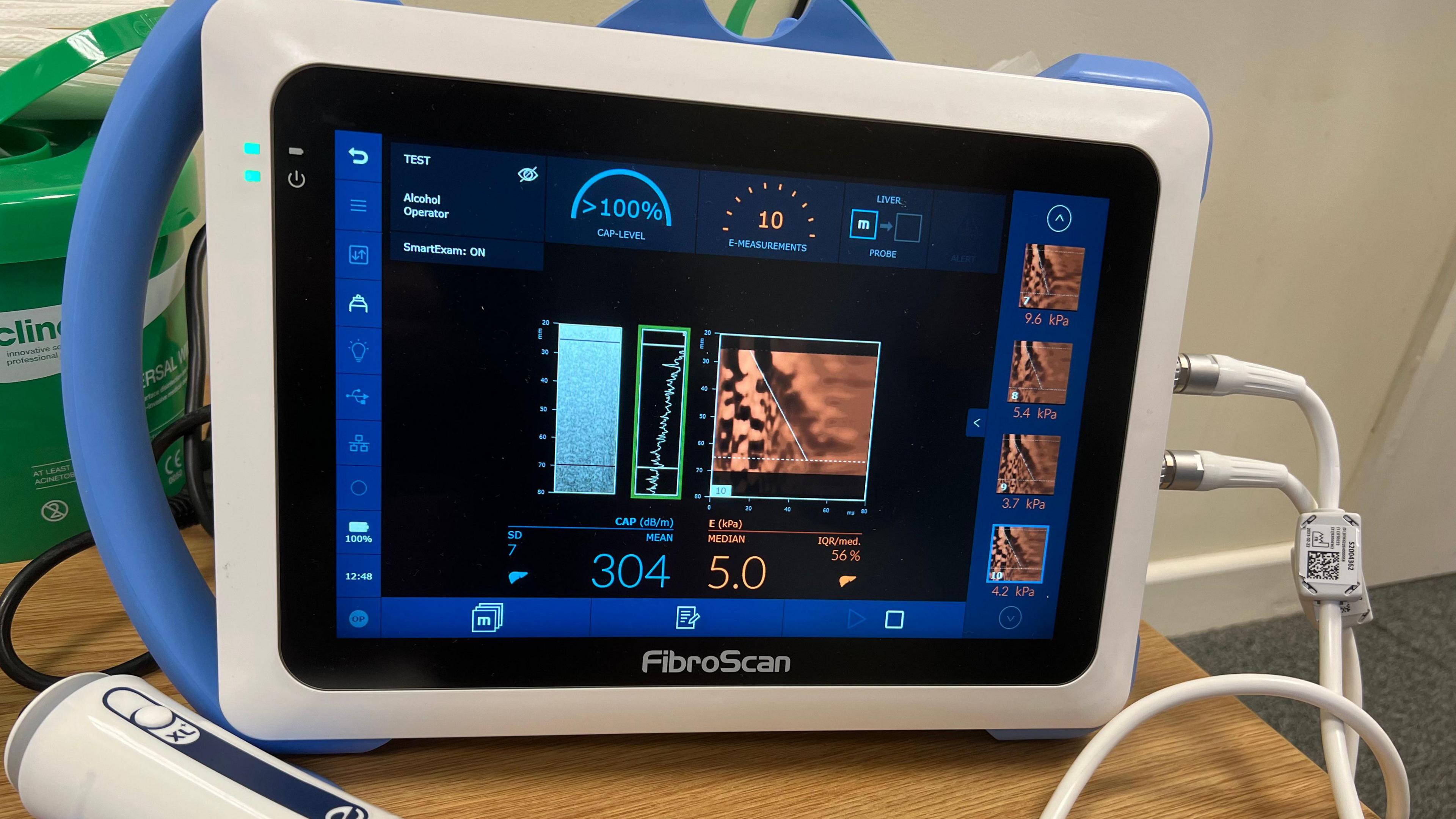 A fibroscanner machine on a wooden table. It is a small rectangular machine with a digital screen and wires coming out of it. The screen shows fuzzy lines and numbers, which indicate the levels of fat and stiffness in the liver