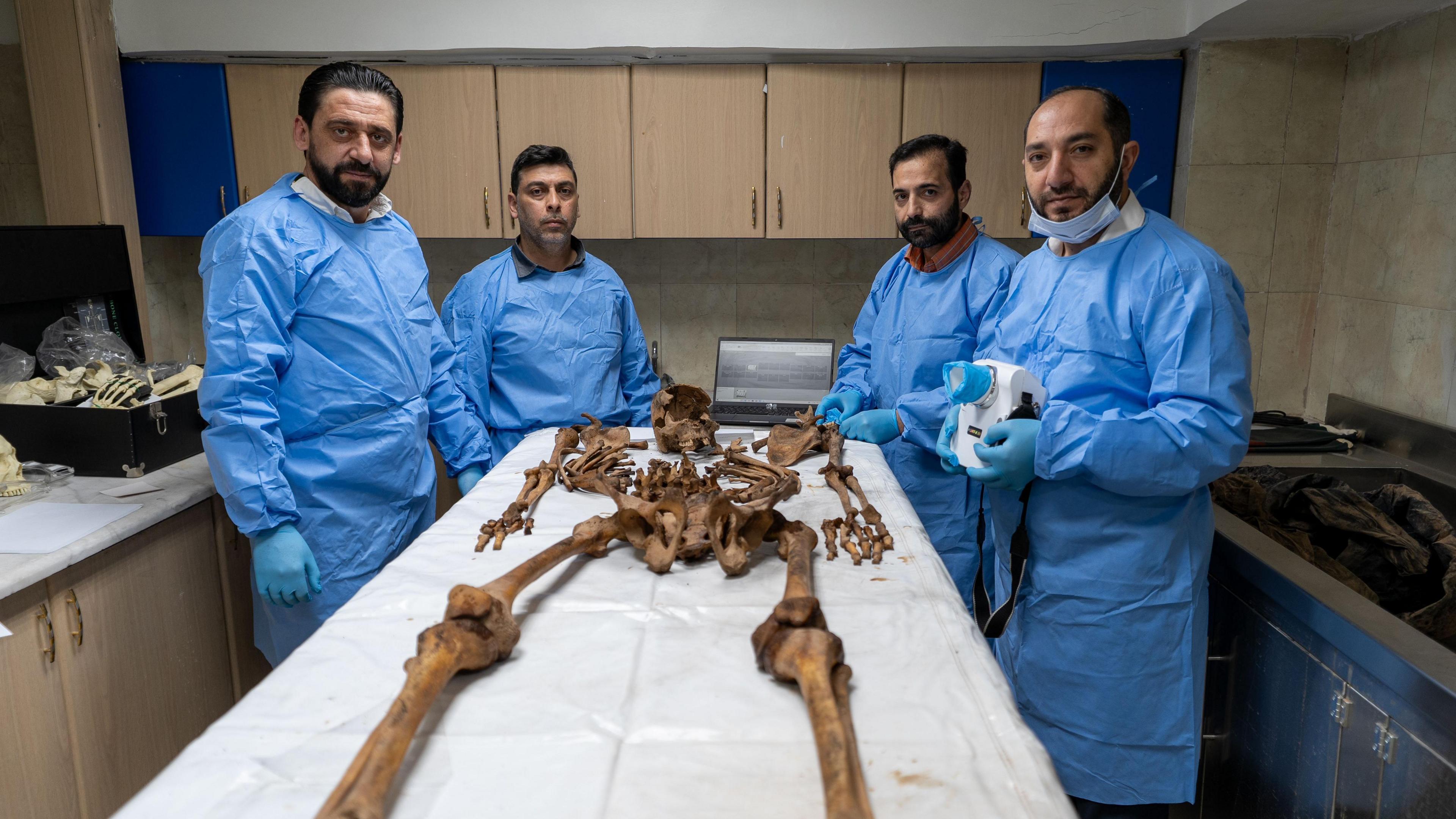 L-R: Dr Taj Eddin Shaker, Dr Anas al-Hourani, Dr Amer Saraqbi and Dr Yasser Al Qassem stand around a skeleton on a table.