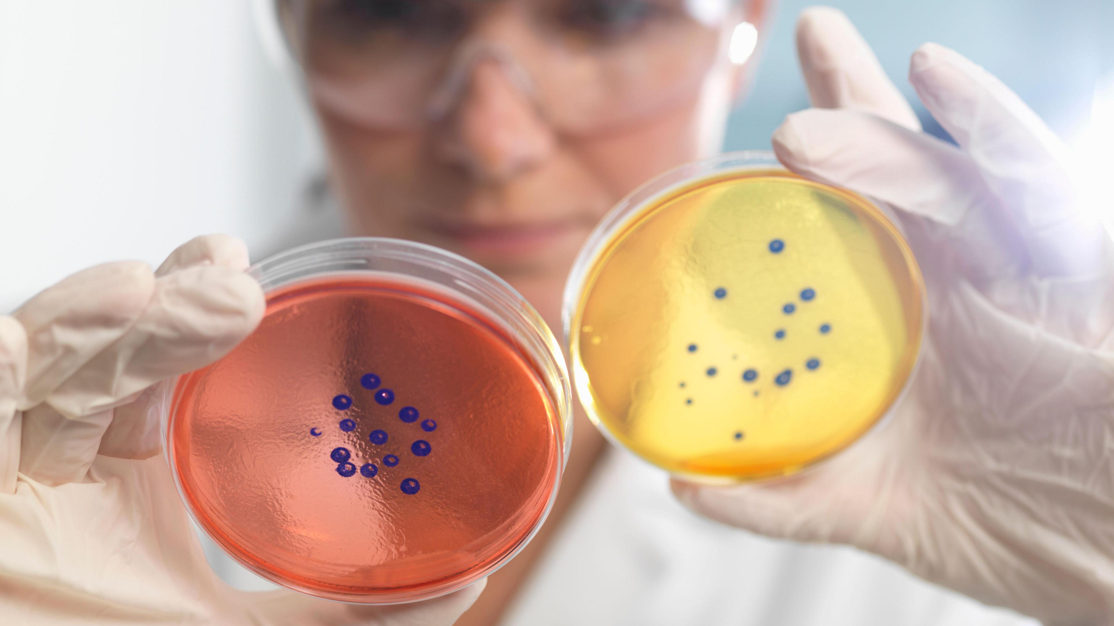 A scientist looks at two petri dishes. One is red and has blue dots on. One is yellow and has blue dots on.