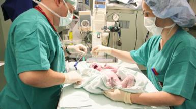 Stock image of newborn baby after cesarean section, being attended to by a male nurse on the left and a female nurse on the right 