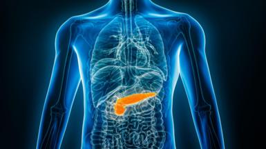 Dealbh x-ray de chom neach leis a' bhrisgean-mhilis air a chomharrachadh le dath oirains