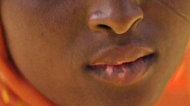 A close-up of a teenage girl, wearing an orange headscarf, main showing her lips which have patches on them as a result of skin-lightening creams.