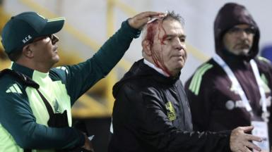 Mexico coach Javier Aguirre with blood pouring down his face after being hit by a can of beer following a game against Honduras